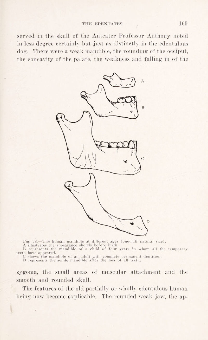 served in the skull of the Aid eater Professor Anthony noted •/ in less degree certainly but just as distinctly in the edentulous dog. There were a weak mandible, the rounding of the occiput, the concavity of the palate, the weakness and falling in of the Fig. 58.—The human mandible at different ages (one-half natural size). A illustrates the appearance shortly before birth. B represents the mandible of a child of four years in whom all the temporary teeth have appeared. C shows the mandible of an adult with complete permanent dentition. D represents the senile mandible after the loss of all teeth. zygoma, the small areas of muscular attachment and the smooth and rounded skulk The features of the old partially or wholly edentulous human being now become explicable. The rounded weak jaw, the ap-