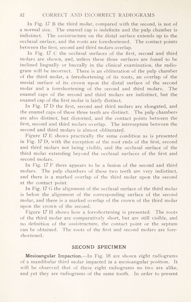 In Fig. 17 B the third molar, compared with the second, is not of a normal size. The enamel cap is indefinite and the pulp chamber is indistinct. The ossistructure on the distal surface extends up to the occlusal surface, and the roots are foreshortened. The contact points between the first, second and third molars overlap. In Eig. 17 C the occlusal surfaces of the first, second and third molars are shown, and, unless these three surfaces are found to be inclined lingually or buccally in the clinical examination, the radio¬ gram will be incorrect. There is an obliteration of the pulp chamber of the third molar, a foreshortening of its roots, an overlap of the mesial surface of its crown upon the distal surface of the second molar and a foreshortening of the second and third molars. The enamel caps of the second and third molars are indistinct, but the enamel cap of the first molar is fairly distinct. In Fig. 17 D the first, second and third molars are elongated, and the enamel caps of these three teeth are distinct. The pulp chambers are also distinct, but distorted, and the contact points between the first, second and third molars overlap. The interseptum between the second and third molars is almost obliterated. Figure 17 E shows practically the same condition as is presented in Eig. 17 D, with the exception of the root ends of the first, second and third molars not being visible, and the occlusal surface of the third molar extending beyond the occlusal surfaces of the first and second molars. In Fig. 17 E there appears to be a fusion of the second and third molars. The pulp chambers of these two teeth are very indistinct, and there is a marked overlap of the third molar upon the second at the contact point. In Eig. 17 G the alignment of the occlusal surface of the third molar is below the alignment of the corresponding surface of the second molar, and there is a marked overlap of the crown of the third molar upon the crown of the second. Figure 17 H shows how a foreshortening is presented. The roots of the third molar are comparatively short, but are still visible, and no definition of the ossistructure, the contact point or the septum can be obtained. The roots of the first and second molars are fore¬ shortened. SECOND SPECIMEN Mesioangular Impaction.—In Fig. 18 are shown eight radiograms of a mandibular third molar impacted in a mesioangular position. It will be observed that of these eight radiograms no two are alike, and yet they are radiograms of the same tooth. In order to present