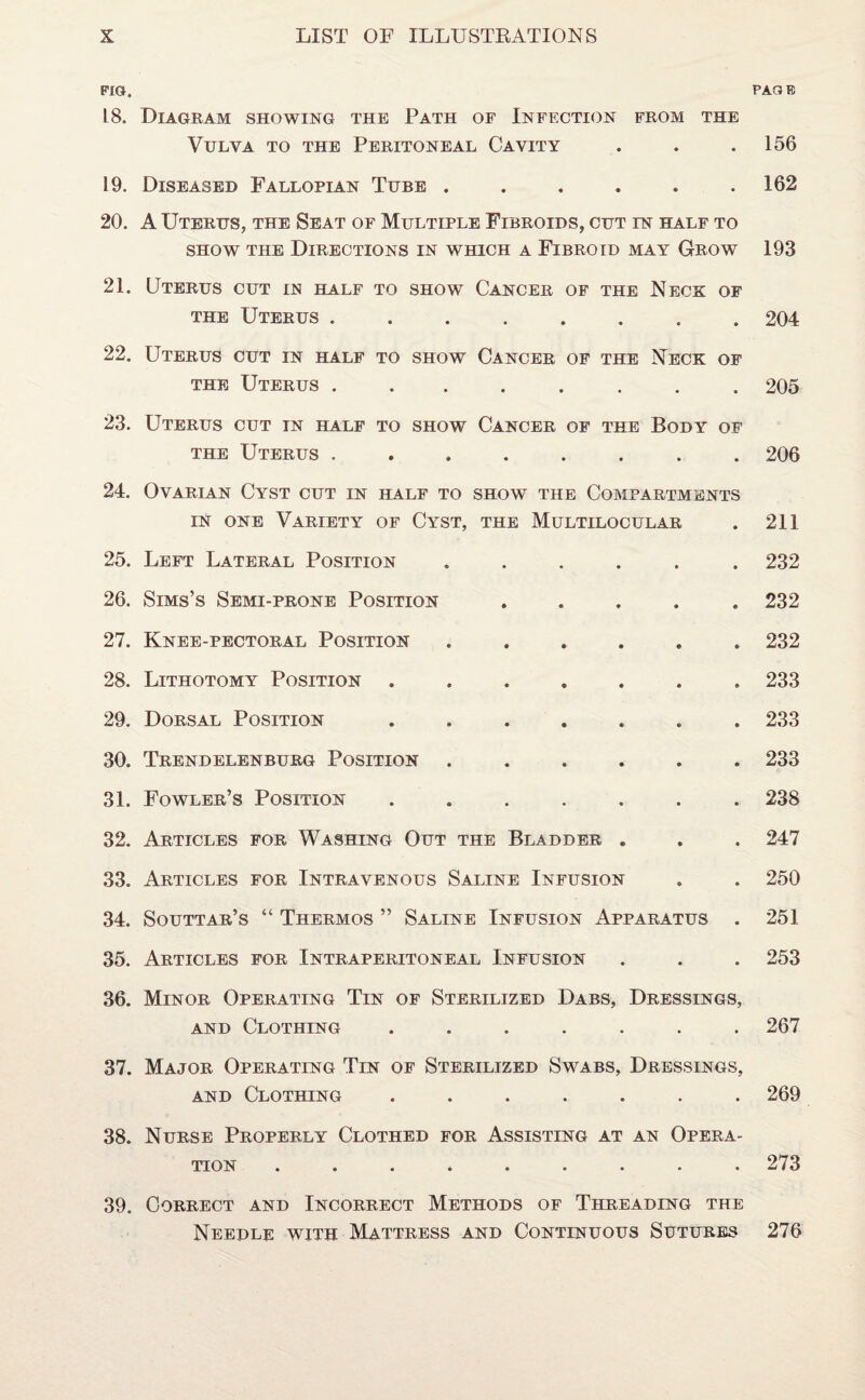 FIG. 18. Diagram showing the Path of Infection from the Vulva to the Peritoneal Cavity 19. Diseased Fallopian Tube ...... 20. A Uterus, the Seat of Multiple Fibroids, cut in half to show the Directions in which a Fibroid may Grow 21. Uterus cut in half to show Cancer of the Neck of the Uterus ........ 22. Uterus cut in half to show Cancer of the Neck of the Uterus ........ 23. Uterus cut in half to show Cancer of the Body of the Uterus ........ 24. Ovarian Cyst cut in half to show the Compartments in one Variety of Cyst, the Multilocular 25. Left Lateral Position ...... 26. Sims’s Semi-prone Position ..... 27. Knee-pectoral Position ...... 28. Lithotomy Position ....... 29. Dorsal Position ....... 30. Trendelenburg Position ...... 31. Fowler’s Position ....... 32. Articles for Washing Out the Bladder . 33. Articles for Intravenous Saline Infusion 34. Souttar’s “ Thermos ” Saline Infusion Apparatus . 35. Articles for Intraperitoneal Infusion 36. Minor Operating Tin of Sterilized Dabs, Dressings, and Clothing ....... 37. Major Operating Tin of Sterilized Swabs, Dressings, and Clothing ....... 38. Nurse Properly Clothed for Assisting at an Opera¬ tion ......... 39. Correct and Incorrect Methods of Threading the Needle with Mattress and Continuous Sutures PAGE 156 162 193 204 205 206 211 232 232 232 233 233 233 238 247 250 251 253 267 269 273 276