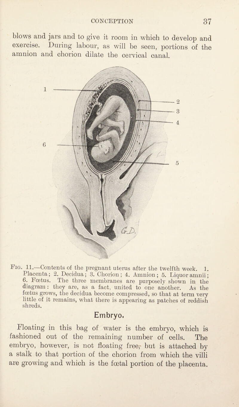 blows and jars and to give it room in which to develop and exercise. During labour, as will be seen, portions of the amnion and chorion dilate the cervical canal. Fig. 11.—Contents of the pregnant uterus after the twelfth week. 1. Placenta; 2. Decidua; 3. Chorion ; 4. Amnion ; 5. Liquor amnii; 6. Foetus. The three membranes are purposely shown in the diagram : they are, as a fact, united to one another. As the foetus grows, the decidua become compressed, so that at term very little of it remains, what there is appearing as patches of reddish shreds. Embryo, Floating in this bag of water is the embryo, which is fashioned out of the remaining number of cells. The embryo, however, is not floating free, but is attached by a stalk to that portion of the chorion from which the villi are growing and which is the foetal portion of the placenta.