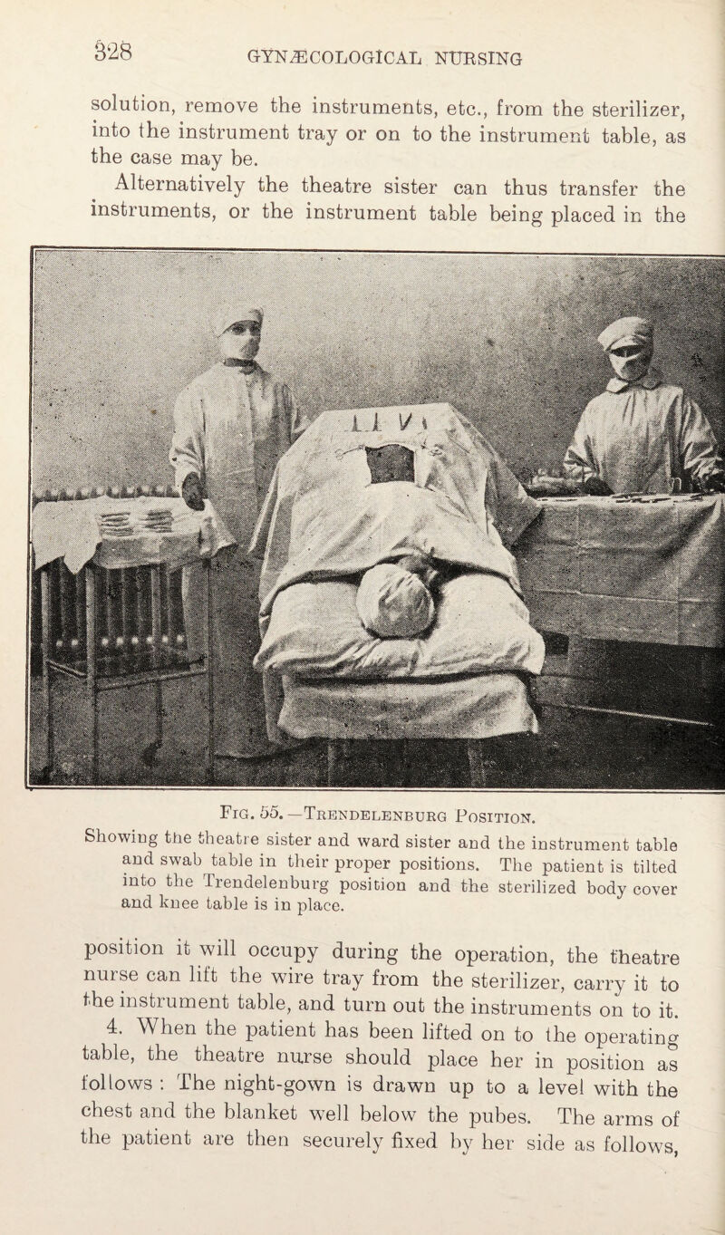 §28 solution, remove the instruments, etc., from the sterilizer, into the instrument tray or on to the instrument table, as the case may be. Alternatively the theatre sister can thus transfer the instruments, or the instrument table being placed in the Fig. 55.—Trendelenburg Position. Showing the theatre sister and ward sister and the instrument table and swab table in their proper positions. The patient is tilted into the Trendelenburg position and the sterilized body cover and knee table is in place. position it will occupy during the operation, the theatre nurse can lift the wire tray from the sterilizer, carry it to the instrument table, and turn out the instruments on to it. 4. When the patient has been lifted on to the operating table, the theatre nurse should place her in position as follows : The night-gown is drawn up to a level with the chest and the blanket well below the pubes. The arms of the patient are then securely fixed by her side as follows,