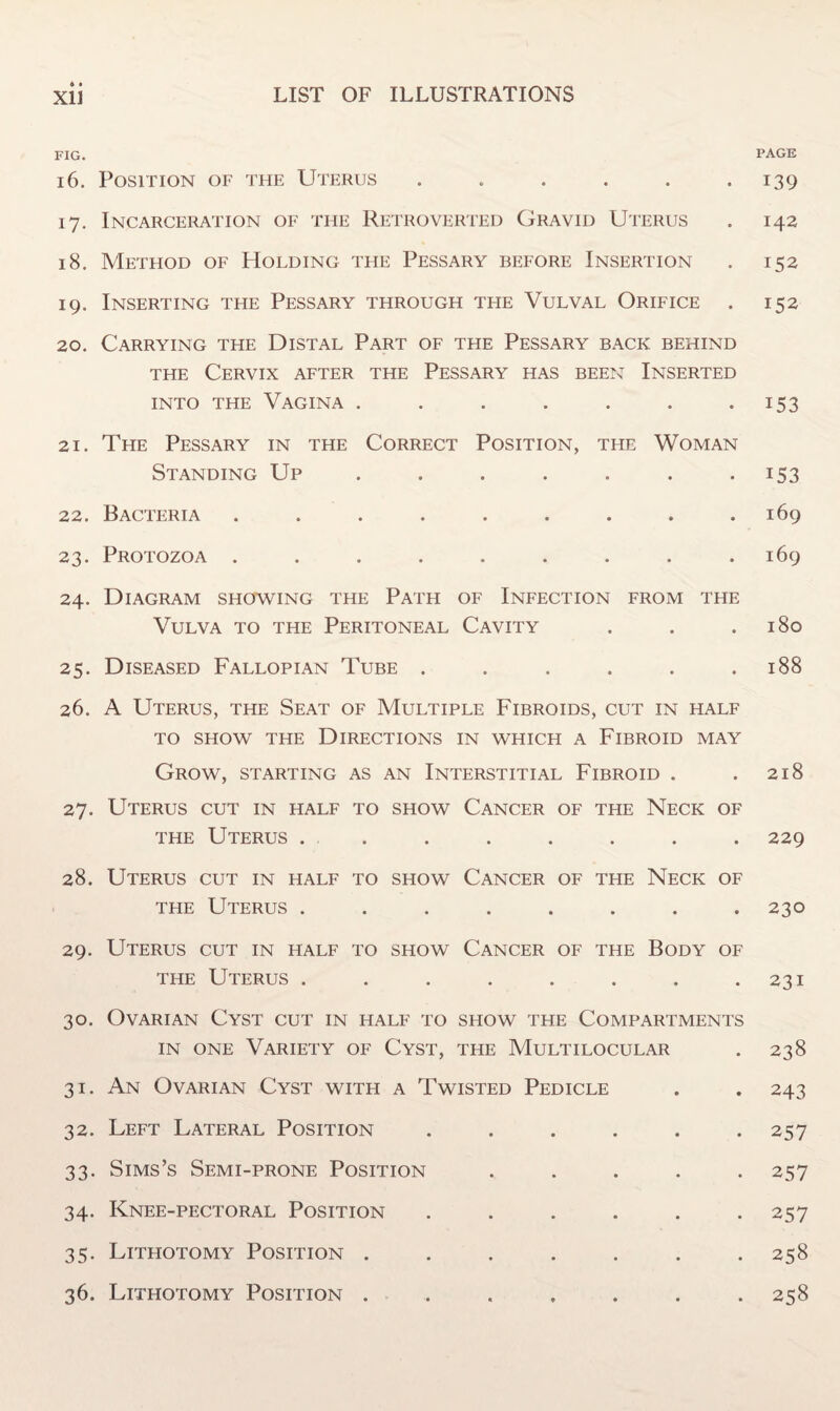 FIG. PAGE 16. Position of the Uterus ...... 139 17. Incarceration of the Retroverted Gravid Uterus . 142 18. Method of Holding the Pessary before Insertion . 152 19. Inserting the Pessary through the Vulval Orifice . 152 20. Carrying the Distal Part of the Pessary back behind the Cervix after the Pessary has been Inserted into the Vagina . . . . . . 153 21. The Pessary in the Correct Position, the Woman Standing Up . . . . . . 153 22. Bacteria . . . . . . . . .169 23. Protozoa . . . . . . . . .169 24. Diagram showing the Path of Infection from the Vulva to the Peritoneal Cavity . . .180 25. Diseased Fallopian Tube . . . . . .188 26. A Uterus, the Seat of Multiple Fibroids, cut in half TO SHOW THE DIRECTIONS IN WHICH A FlBROID MAY Grow, starting as an Interstitial Fibroid . . 218 27. Uterus cut in half to show Cancer of the Neck of the Uterus . . . . . . . . 229 28. Uterus cut in half to show Cancer of the Neck of the Uterus ........ 230 29. Uterus cut in half to show Cancer of the Body of the Uterus . . . . . . . .231 30. Ovarian Cyst cut in half to show the Compartments in one Variety of Cyst, the Multilocular . 238 31. An Ovarian Cyst with a Twisted Pedicle . . 243 32. Left Lateral Position . . . . . .257 33. Sims’s Semi-prone Position ..... 257 34. Knee-pectoral Position . . . . . .257 35. Lithotomy Position . . . . . . .258 36. Lithotomy Position ....... 258