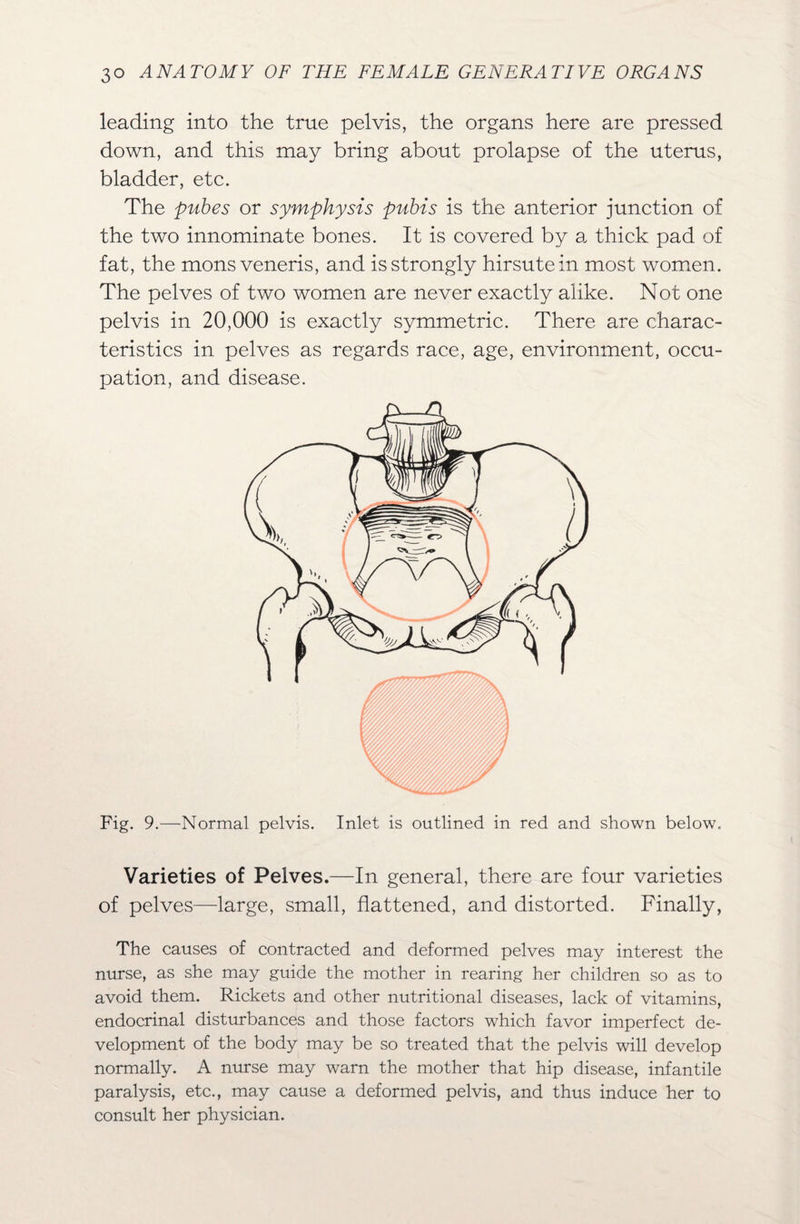 leading into the true pelvis, the organs here are pressed down, and this may bring about prolapse of the uterus, bladder, etc. The pubes or symphysis pubis is the anterior junction of the two innominate bones. It is covered by a, thick pad of fat, the mons veneris, and is strongly hirsute in most women. The pelves of two women are never exactly alike. Not one pelvis in 20,000 is exactly symmetric. There are charac¬ teristics in pelves as regards race, age, environment, occu¬ pation, and disease. Fig. 9.—Normal pelvis. Inlet is outlined in red and shown below. Varieties of Pelves.—In general, there are four varieties of pelves—large, small, flattened, and distorted. Finally, The causes of contracted and deformed pelves may interest the nurse, as she may guide the mother in rearing her children so as to avoid them. Rickets and other nutritional diseases, lack of vitamins, endocrinal disturbances and those factors which favor imperfect de¬ velopment of the body may be so treated that the pelvis will develop normally. A nurse may warn the mother that hip disease, infantile paralysis, etc., may cause a deformed pelvis, and thus induce her to consult her physician.