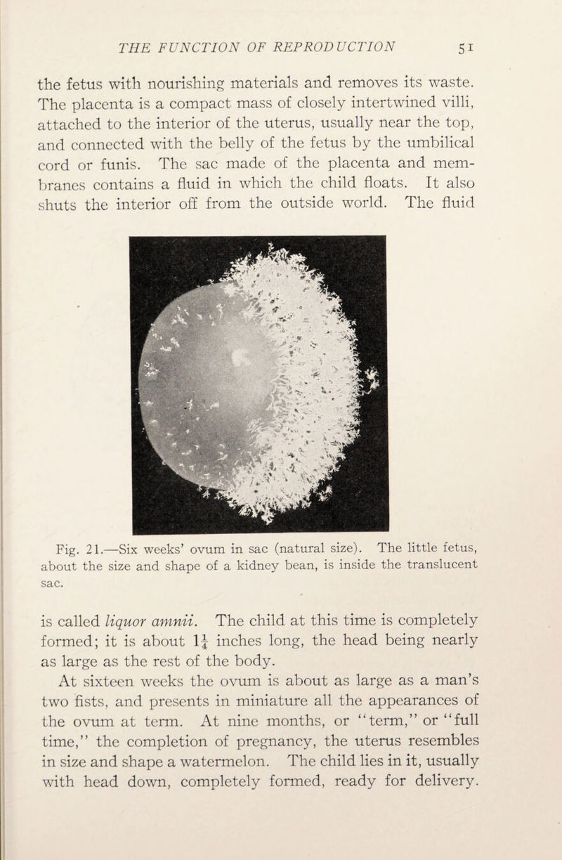 the fetus with nourishing materials and removes its waste. The placenta is a compact mass of closely intertwined villi, attached to the interior of the uterus, usually near the top, and connected with the belly of the fetus by the umbilical cord or funis. The sac made of the placenta and mem¬ branes contains a fluid in which the child floats. It also shuts the interior off from the outside world. The fluid Fig. 21.—Six weeks’ ovum in sac (natural size). The little fetus, about the size and shape of a kidney bean, is inside the translucent sac. is called liquor amnii. The child at this time is completely formed; it is about 1J inches long, the head being nearly as large as the rest of the body. At sixteen weeks the ovum is about as large as a man’s two fists, and presents in miniature all the appearances of the ovum at term. At nine months, or “term,” or “full time,” the completion of pregnancy, the uterus resembles in size and shape a watermelon. The child lies in it, usually with head down, completely formed, ready for delivery.