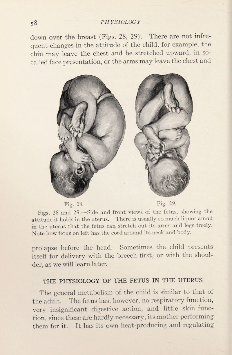 down over the breast (Figs. 28, 29). There are not infre¬ quent changes in the attitude of the child, for example, the chin may leave the chest and be stretched upward, in so- called face presentation, or the arms may leave the chest and Fig. 28. Fig. 29. Figs. 28 and 29.—Side and front views of the fetus, showing the attitude it holds in the uterus. There is usually so much liquor amnii in the uterus that the fetus can stretch out its arms and legs freely. Note how fetus on left has the cord around its neck and body. prolapse before the head. Sometimes the child presents itself for delivery with the breech first, or with the shoul¬ der, as we will learn later. THE PHYSIOLOGY OF THE FETUS IN THE UTERUS The general metabolism of the child is similar to that of the adult. The fetus has, however, no respiratory function, very insignificant digestive action, and little skin func¬ tion, since these are hardly necessary, its mother performing them for it. It has its own heat-producing and regulating