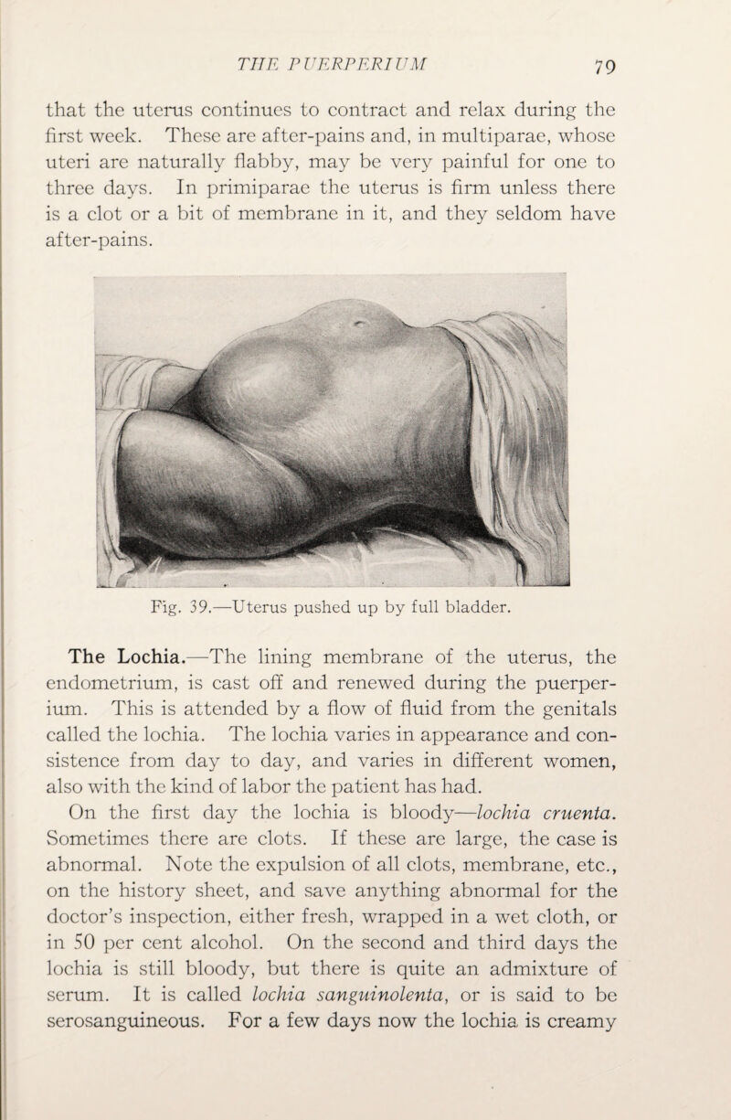 that the uterus continues to contract and relax during the first week. These are after-pains and, in multiparae, whose uteri are naturally flabby, may be very painful for one to three days. In primiparae the uterus is firm unless there is a clot or a bit of membrane in it, and they seldom have after-pains. Fig. 39.—Uterus pushed up by full bladder. The Lochia.—The lining membrane of the uterus, the endometrium, is cast off and renewed during the puerper- ium. This is attended by a flow of fluid from the genitals called the lochia. The lochia varies in appearance and con¬ sistence from day to day, and varies in different women, also with the kind of labor the patient has had. On the first day the lochia is bloody—lochia cruenta. Sometimes there are clots. If these are large, the case is abnormal. Note the expulsion of all clots, membrane, etc., on the history sheet, and save anything abnormal for the doctor’s inspection, either fresh, wrapped in a wet cloth, or in 50 per cent alcohol. On the second and third days the lochia is still bloody, but there is quite an admixture of serum. It is called lochia sanguinolenta, or is said to be serosanguineous. For a few days now the lochia is creamy