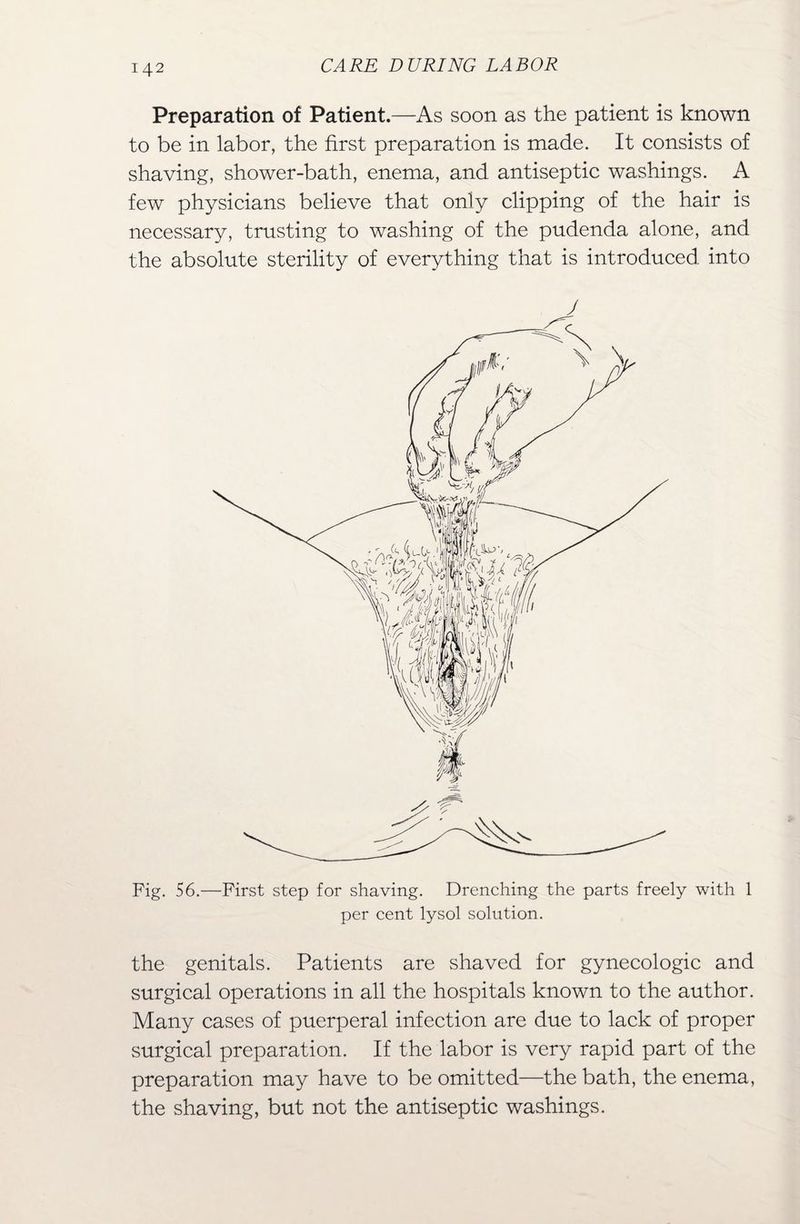 Preparation of Patient.—As soon as the patient is known to be in labor, the first preparation is made. It consists of shaving, shower-bath, enema, and antiseptic washings. A few physicians believe that only clipping of the hair is necessary, trusting to washing of the pudenda alone, and the absolute sterility of everything that is introduced into J Fig. 56.—First step for shaving. Drenching the parts freely with 1 per cent lysol solution. the genitals. Patients are shaved for gynecologic and surgical operations in all the hospitals known to the author. Many cases of puerperal infection are due to lack of proper surgical preparation. If the labor is very rapid part of the preparation may have to be omitted—the bath, the enema, the shaving, but not the antiseptic washings.