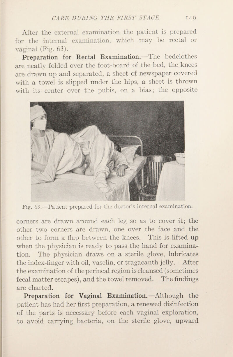 After the external examination the patient is prepared for the internal examination, which may be rectal or vaginal (Fig. 63). Preparation for Rectal Examination.—The bedclothes are neatly folded over the foot-board of the bed, the knees are drawn up and separated, a sheet of newspaper covered with a towel is slipped under the hips, a sheet is thrown with its center over the pubis, on a bias; the opposite Fig. 63.—Patient prepared for the doctor’s internal examination. corners are drawn around each leg so as to cover it; the other two corners are drawn, one over the face and the other to form a flap between the knees. This is lifted up when the physician is ready to pass the hand for examina¬ tion. The physician draws on a sterile glove, lubricates the index-finger with oil, vaselin, or tragacanth jelly. After the examination of the perineal region is cleansed (sometimes fecal matter escapes), and the towel removed. The findings are charted. Preparation for Vaginal Examination.—Although the patient has had her first preparation, a renewed disinfection of the parts is necessary before each vaginal exploration, to avoid carrying bacteria, on the sterile glove, upward