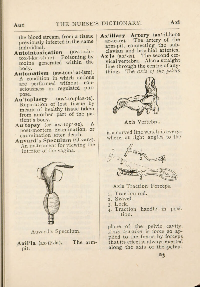 Axi the blood stream, from a tissue previously infected in the same individual. Autointoxication (aw-to-in- tox-i-ka'-shun). Poisoning by , toxins generated within the | body. Automatism (aw-tom'-at-ism). A condition in which actions ^ are performed without con- i sciousness or regulated pur¬ pose. Au'toplasty (aw'-to-plas-te). j Reparation of lost tissue by j means of healthy tissue taken < from another part of the pa¬ tient’s body. Au'topsy (or aw-top'-se). A post-mortem examination, or examination after death. Auvard’s Speculum (0-varz). An instrument for viewing the interior of the vagina. Auvard’s Speculum. Axil'ia (ax-il'-la). The arm- pit. Ax'illary Artery (ax'-il-la-re ar-te-re). The artery of the arm-pit, connecting the sub¬ clavian and brachial arteries. Ax'is (ax'-is). The second cer- vical vertebra. Also a straight line through the centre of any¬ thing. The axis of the pelvis Axis Vertebra. is a curved line which is every¬ where at right angles to the Axis Traction Forceps. 1. Traction red. 2. Swivel. 3. Lock. 4. Traction handle in posi¬ tion. plane of the pelvic cavity. Axis traction is force so ap¬ plied to the foetus by forceps that its effect is always exerted along the axis of the pelvis