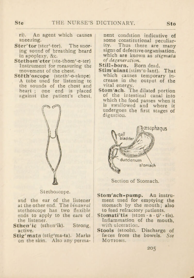 ri). An agent which causes sneezing. Ster'tor (ster'-tor). The snor¬ ing sound of breathing heard in apoplexy, &c. Stethoin'eter (ste-thom'-e-ter) Instrument for measuring the movement of the chest. Stgth'oscope (steth'-o-skope) A tube used for listening tc the sounds of the chest and heart ; one end is placed against the patient's chest, Stethoscope. and the ear of the listener at the other end. The binaural stethoscope has two flexible ends to apply to the ears of the listener. Sthen'ic (sthen'ik). Strong, active. Stljr'mata (stig'ma-ta). Marks on the skin. Also any perma¬ nent condition indicative of some constitutional peculiar¬ ity. Thus there are many signs of defective organisation, which are known as stigmata of degeneration. Still-born. Born dead. Stlni'ulant(slim'u-lant). That which causes temporary in¬ crease in the output of the vital energy. Stom'ach. The dilated portion of the intestinal canal into which the food passes when it is swallowed and where it undergoes the first stages of digestion. Section of Stomach. Stom'ach-pump. An instru¬ ment used for emptying the stomach by the mouth; also to feed refractory patients. Stomati'tis (stom - a - ti'- tis). Inflammation of the mouth, with ulceration. Stools (stools). Discharge of faeces from the bowels. See Motions.