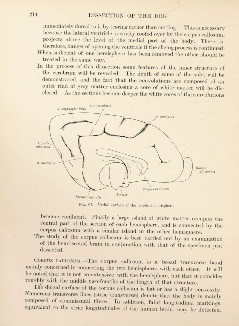 immediately dorsal to it by tearing rather than cutting. This is necessary because the lateral ventricle, a cavity roofed over by the corpus callosum, projects above the level of the medial part of the body. There is, therefore, danger of opening the ventricle if the slicing process is continued. When sufficient of one hemisphere has been removed the other should be treated in the same way. In the process of this dissection some features of the inner structure of the cerebrum will be revealed. The depth of some of the sulci will be demonstrated, and the fact that- the convolutions are composed of an outer rind of grey matter enclosing a core of white matter will be dis¬ closed. As the sections become deeper the white cores of the convolutions s. intercalans s. suprasplenialis , Bulhus olfactnrius become confluent. Finally a large island of white matter occupies the central part of the section of each hemisphere, and is connected by the coipus callosum with a similar island in the other hemisphere. The study of the corpus callosum is best carried out by an examination of the hemi-sected brain in conjunction with that of the specimen just dissected. Corpus callosum.—The corpus callosum is a broad transverse band mainly concerned in connecting the two hemispheres with each other. It will be noted that it is not co-extensive with the hemisphere, but that it coincides roughly with the middle two-fourths of the length of that structure. Th*e doisal surface of the corpus callosum is flat or has a slight convexity. Numerous transverse lines (striae transversae) denote that the body is mainly composed of commissural fibres. In addition, faint longitudinal markings, equivalent to the striae longitudinales of the human brain, may be detected!