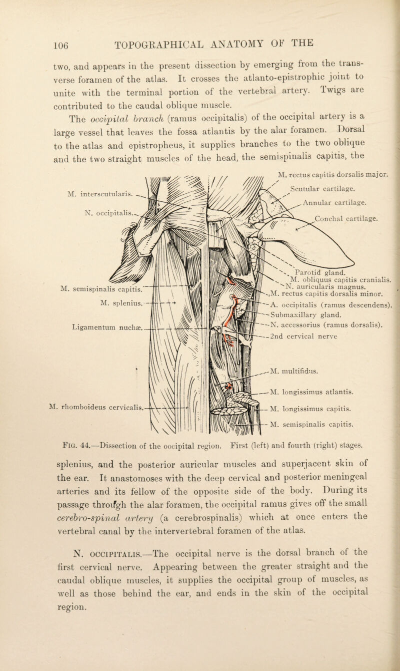 two, and appears in the present dissection by emerging from the trans¬ verse foramen of the atlas. It crosses the atlanto-epistiophic joint to unite with the terminal portion of the vertebral artery. Iwigs are contributed to the caudal oblique muscle. The occipital branch (ramus occipitalis) of the occipital artery is a large vessel that leaves the fossa atlantis by the alar foramen. Dorsal to the atlas and epistropheus, it supplies branches to the two oblique and the two straight muscles of the head, the semispinalis capitis, the O M. interscvitularis. N. occipitalis. M. rectus capitis dorsalis major. Scutular cartilage. ✓ ^.Annular cartilage. Conchal cartilage. M. semispinalis capitis.’ M. splenitis. - Ligamentum nuchse M. rliomboideus cervicalis Parotid gland. ^ M. obliquus capitis cranialis. ''N. auricularis magnus. -,M. rectus capitis dorsalis minor. A. occipitalis (ramus descendens). -Submaxillary gland. -N. accessorius (ramus dorsalis). -2nd cervical nerve M, longissimus atlantis. M. longissimus capitis. M. semispinalis capitis. Fig. 44.—Dissection of the occipital region. First (left) and fourth (right) stages. splenitis, and the posterior auricular muscles and superjacent skin of the ear. It anastomoses with the deep cervical and posterior meningeal arteries and its fellow of the opposite side of the body. During its passage throifgh the alar foramen, the occipital ramus gives off the small cerebrospinal artery (a cerebrospinalis) which at once enters the vertebral canal by the intervertebral foramen of the atlas. N. OCCIPITALIS.—The occipital nerve is the dorsal branch of the first cervical nerve. Appearing between the greater straight and the caudal oblique muscles, it supplies the occipital group of muscles, as well as those behind the ear, and ends in the skin of the occipital region.