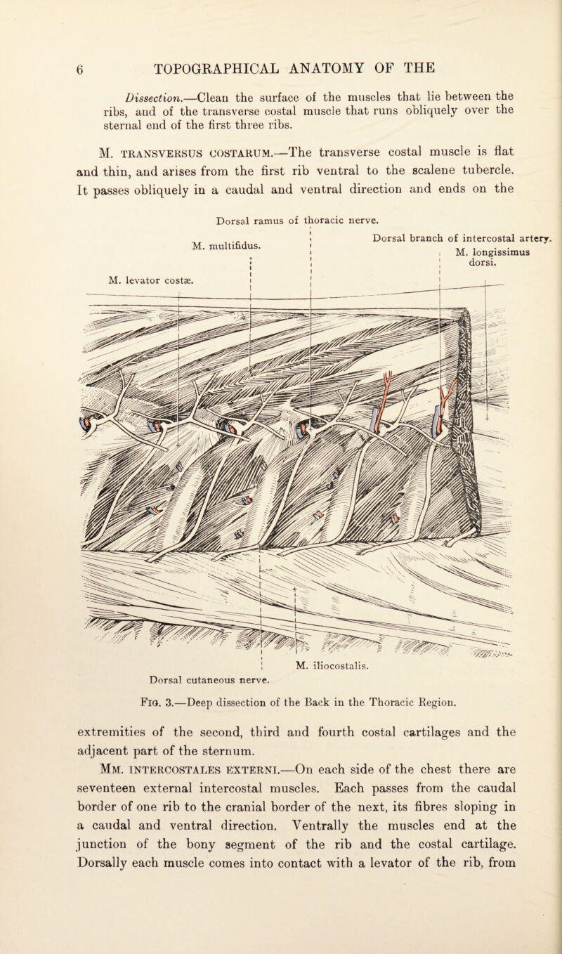 Dissection.—Clean the surface of the muscles that lie between the ribs, and of the transverse costal muscle that runs obliquely over the sternal end of the first three ribs. M. transversus costarum.—The transverse costal muscle is flat and thin, and arises from the first rib ventral to the scalene tubercle. It passes obliquely in a caudal and ventral direction and ends on the Dorsal ramus of thoracic nerve. Dorsal branch of intercostal artery. M. multifidus. M. longissimus dorsi. M. levator costae. M. iliocostalis. Dorsal cutaneous nerve. Fia. 3.—Deep dissection of the Back in the Thoracic Region. extremities of the second, third and fourth costal cartilages and the adjacent part of the sternum. Mm. intercostales externi.—On each side of the chest there are seventeen external intercostal muscles. Each passes from the caudal border of one rib to the cranial border of the next, its fibres sloping in a caudal and ventral direction. Ventrally the muscles end at the junction of the bony segment of the rib and the costal cartilage. Dorsally each muscle comes into contact with a levator of the rib, from