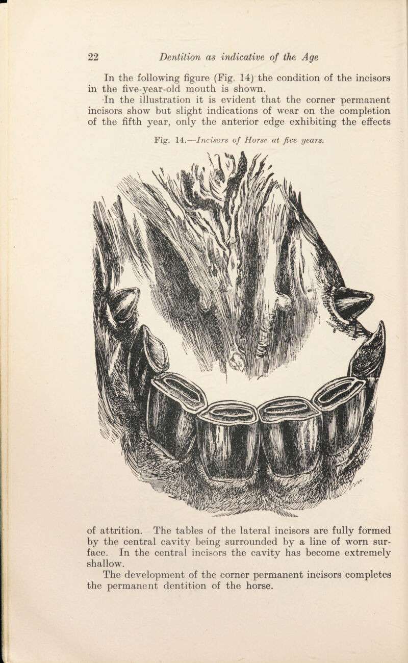 In the following figure (Fig. 14) the condition of the incisors in the five-year-old mouth is shown. •In the illustration it is evident that the corner permanent incisors show but slight indications of wear on the completion of the fifth year, only the anterior edge exhibiting the effects Fig. 14.—Incisors of Horse at five years. of attrition. The tables of the lateral incisors are fully formed by the central cavity being surrounded by a line of worn sur¬ face. In the central incisors the cavity has become extremely shallow. The development of the corner permanent incisors completes the permanent dentition of the horse.