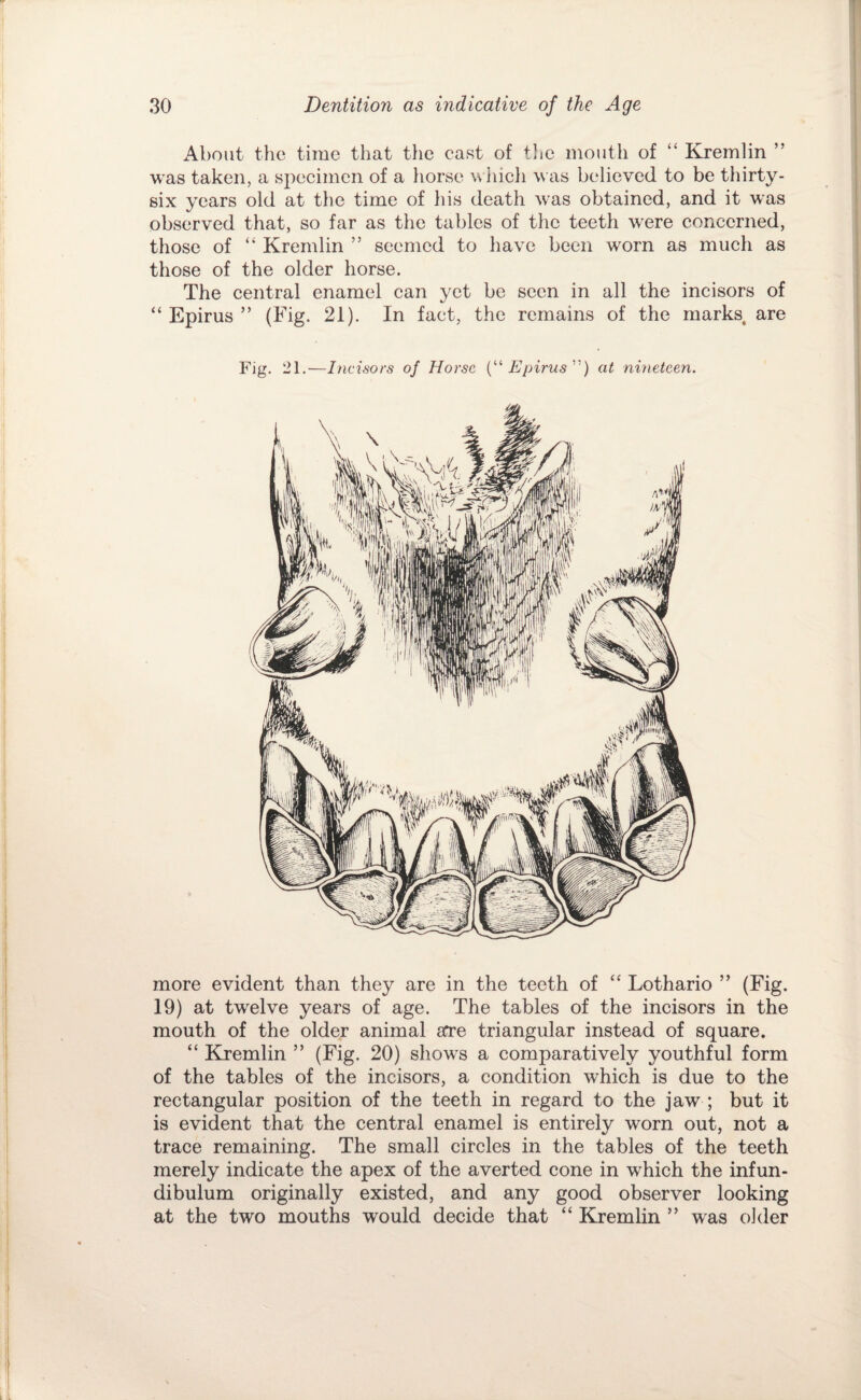 About the time that tlie cast of the mouth of “ Kremlin ” was taken, a specimen of a horse wiiicli was believed to be thirty- six years old at the time of his death was obtained, and it was observed that, so far as the tables of the teeth w'ere concerned, those of “ Kremlin ” seemed to have been worn as much as those of the older horse. The central enamel can yet be seen in all the incisors of “ Epirus ” (Eig. 21). In fact, the remains of the marks, are Fig. 21.—Incisors of Horse Epirus'^) at nineteen. more evident than they are in the teeth of “ Lothario ” (Fig. 19) at twelve years of age. The tables of the incisors in the mouth of the older animal are triangular instead of square. “ Kremlin ” (Fig. 20) shows a comparatively youthful form of the tables of the incisors, a condition which is due to the rectangular position of the teeth in regard to the jaw ; but it is evident that the central enamel is entirely worn out, not a trace remaining. The small circles in the tables of the teeth merely indicate the apex of the averted cone in which the infun¬ dibulum originally existed, and any good observer looking at the two mouths would decide that “ Kremlin ” was older