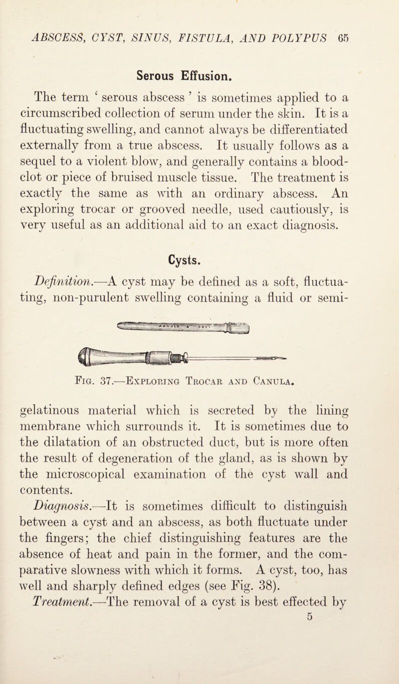 Serous Effusion. The term 4 serous abscess ’ is sometimes applied to a circumscribed collection of serum under the skin. It is a fluctuating swelling, and cannot always be differentiated externally from a true abscess. It usually follows as a sequel to a violent blow, and generally contains a blood- clot or piece of bruised muscle tissue. The treatment is exactly the same as with an ordinary abscess. An exploring trocar or grooved needle, used cautiously, is very useful as an additional aid to an exact diagnosis. Cysts. Definition.—A cyst may be defined as a soft, fluctua¬ ting, non-purulent swelling containing a fluid or semi- Fig. 37.—Exploring Trocar and Canula. gelatinous material which is secreted by the lining membrane which surrounds it. It is sometimes due to the dilatation of an obstructed duct, but is more often the result of degeneration of the gland, as is shown by the microscopical examination of the cyst wall and contents. Diagnosis.—-It is sometimes difficult to distinguish between a cyst and an abscess, as both fluctuate under the fingers; the chief distinguishing features are the absence of heat and pain in the former, and the com¬ parative slowness with which it forms. A cyst, too, has well and sharply defined edges (see Fig. 38). Treatment.—The removal of a cyst is best effected by