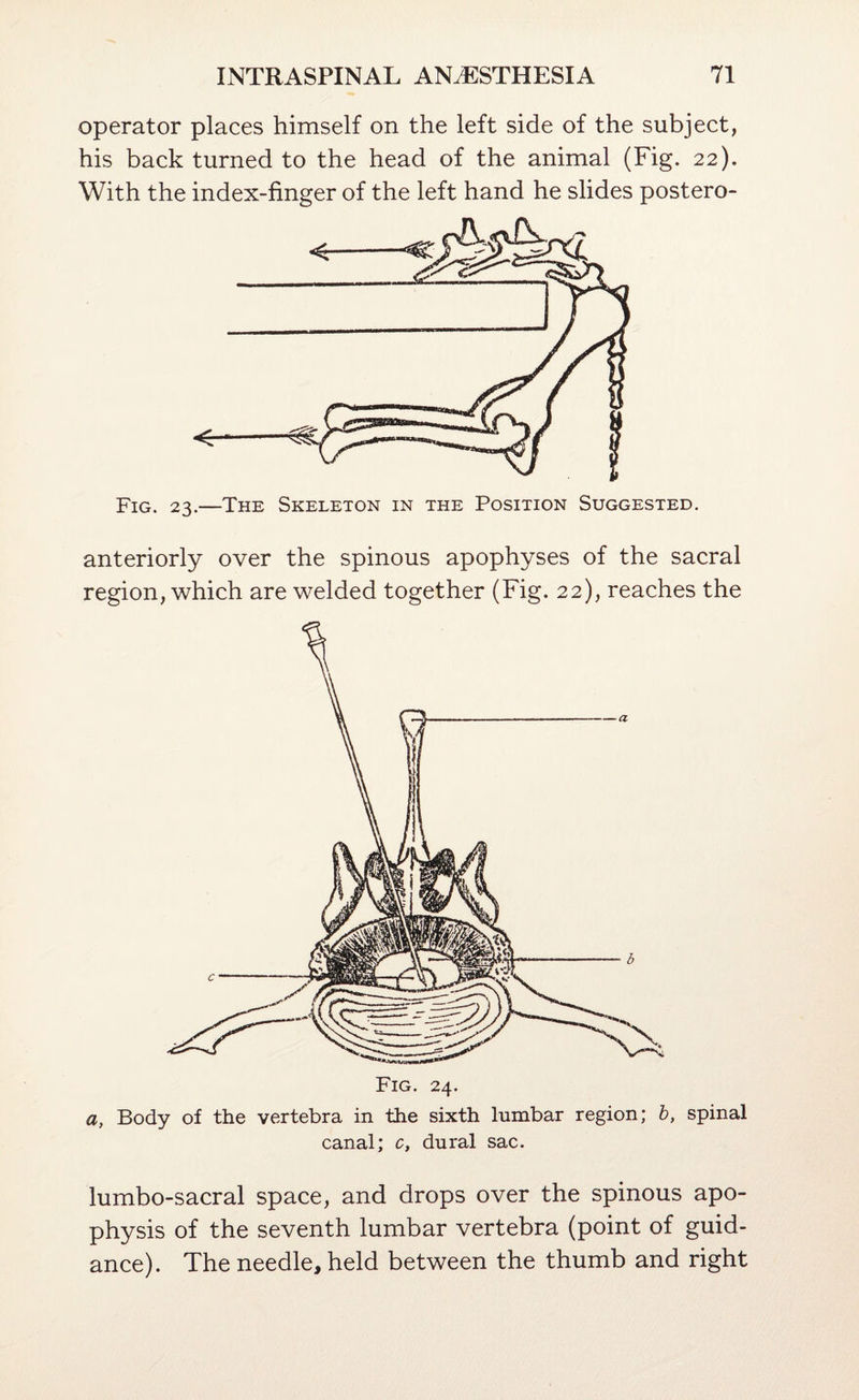operator places himself on the left side of the subject, his back turned to the head of the animal (Fig. 22). With the index-finger of the left hand he slides postero- anteriorly over the spinous apophyses of the sacral region, which are welded together (Fig. 22), reaches the Fig. 24. a, Body of the vertebra in the sixth lumbar region; h, spinal canal; c, dural sac. lumbo-sacral space, and drops over the spinous apo¬ physis of the seventh lumbar vertebra (point of guid¬ ance). The needle, held between the thumb and right