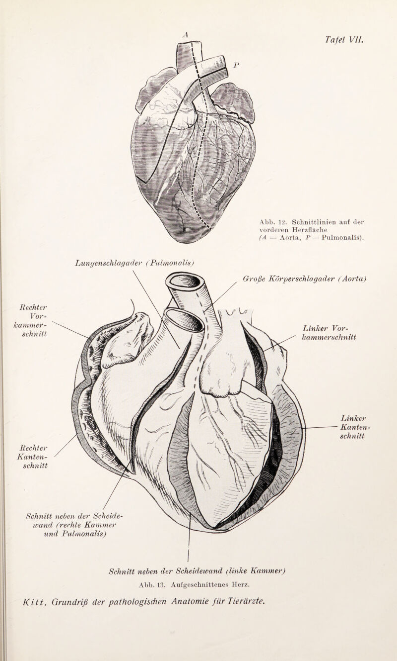 Abb. 12. Schnittlinien auf der vorderen Herzfläche (A — Aorta, P Pulmonalis). Lungenschlagader (Pulmonalis) Große Körperschlagader (Aorta) Rechter Vor¬ kammer¬ schnitt Rechter Kanten¬ schnitt Linker Vor¬ kammerschnitt Linker Kanten- schnitt Schnitt neben der Scheide- wand (rechte Kammer und Pulmonalis) Schnitt neben der Scheidewand (linke Kammer) Abb. 13. Aufgeschnittenes Herz.