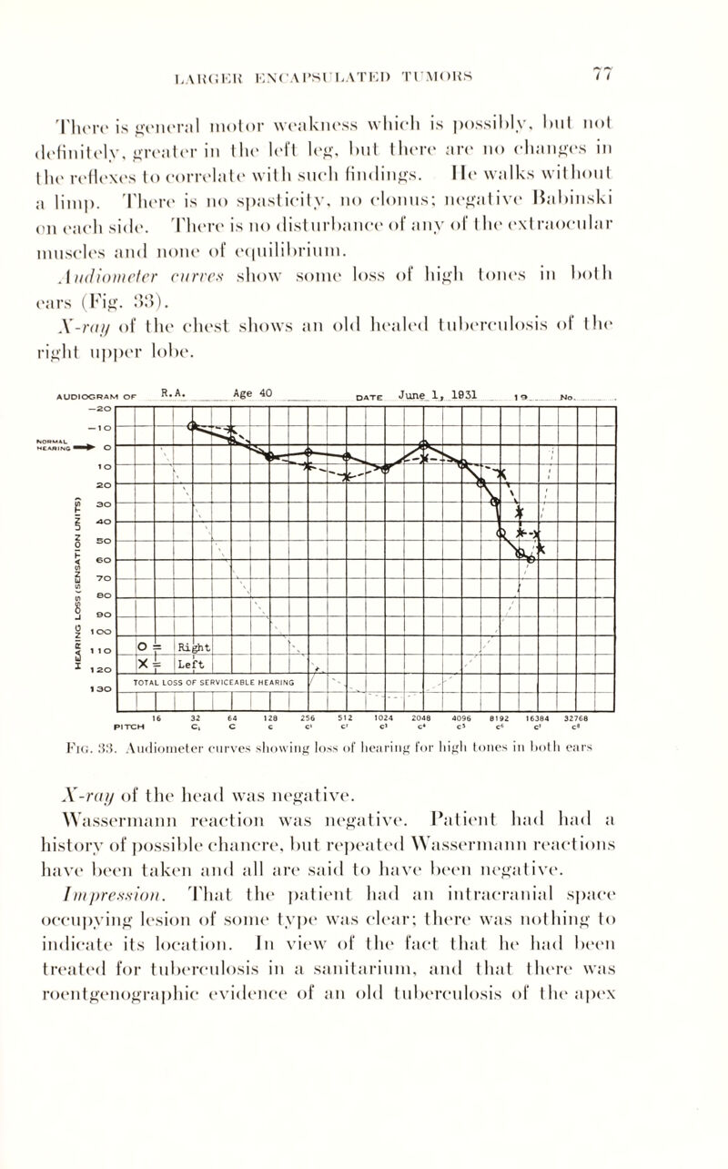 LAlUiKK KNCAPSn.ATKI) TI MOliS I I There is general motor weakness which is possibly, hut not definitely, greater in the left leg, hut there are no changes in the reflexes to correlate with such findings. lie walks without a limp. There is no spasticity, no clonus; negative Babinski on each side. There is no disturbance of any of I he c\l raoeular muscles and none of equilibrium. Audiometer curves show some loss of high tones in both ears (Fig. 33). X-ntji of the chest shows an old healed tuberculosis of the right upper lobe. 16 32 64 128 256 512 1024 2048 4096 8192 16384 32768 PITCH Cl C C C* c* c> c* c5 c6 c> c® Fig. 33. Audiometer curves showing loss of hearing for high tones in both ears X-ray of the head was negative. Wassermann reaction was negative. Patient had had a history of possible chancre, but repeated Wassermann reactions have been taken and all are said to have been negative. Impression. That the patient had an intracranial space occupying lesion of some type was clear; there was nothing to indicate its location. In view of the fact that lie had been treated for tuberculosis in a sanitarium, and that there was roentgenographic evidence of an old tuberculosis of the apex