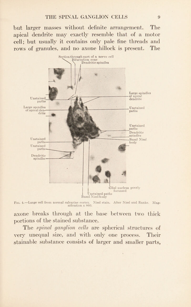 but larger masses without definite arrangement. The apical dendrite may exactly resemble that of a motor cell; but usually it contains only pale fine threads and rows of granules, and no axone hillock is present. The Section through part of a nerve cell Bifurcation cone \ Dendritic spindles Unstained. paths Large spindles of apical den¬ drite Unstained paths Unstained paths Dendritic spindles Large spindles of apical dendrite Unstained paths Unstained paths Dendritic spindles -Basal Nissl body Glial nucleus poorly focussed instained paths Basal Nissl body Fig. 4.—Large cell from normal calcarine cortex. Nissl stain. After Nissl and Ranke. Mag¬ nification x 860. axone breaks through at the base between two thick portions of the stained substance. The spinal ganglion cells are spherical structures of very unequal size, and with only one process. Their stainable substance consists of larger and smaller parts,