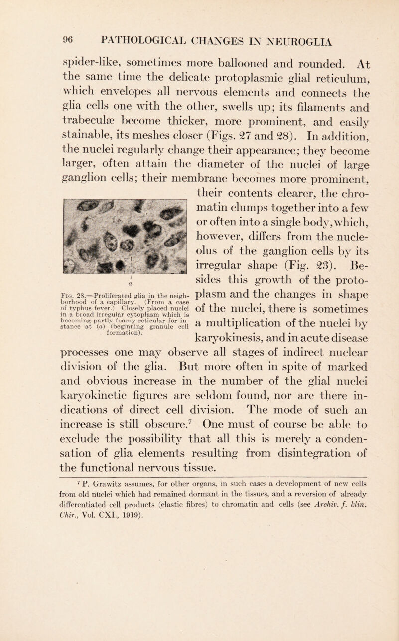 spider-like, sometimes more ballooned and rounded. At the same time the delicate protoplasmic glial reticulum, which envelopes all nervous elements and connects the glia cells one with the other, swells up; its filaments and trabeculae become thicker, more prominent, and easily stainable, its meshes closer (Figs. 27 and 28). In addition, the nuclei regularly change their appearance; they become larger, often attain the diameter of the nuclei of large ganglion cells; their membrane becomes more prominent. their contents clearer, the chro¬ matin chimps together into a few or often into a single body, which, however, differs from the nucle¬ olus of the ganglion cells by its irregular shape (Fig. 23). Be¬ sides this growth of the proto- Fig. 28.—Proliferated glia in the neigh- plasm and the changes in shape borhood of a capillary. (From a case pi l * i • • of typhus fever.) closely placed nuclei of the nuclei, there is sometimes m a broad irregular cytoplasm which is stance*1^ ^^^beginmiig^g^a^iuf^ceii a multiplication of the nuclei by formation). -i i • • 1 • , . karyokmesis, and m acute disease processes one may observe all stages of indirect nuclear division of the glia. But more often in spite of marked and obvious increase in the number of the glial nuclei karyokinetic figures are seldom found, nor are there in¬ dications of direct cell division. The mode of such an increase is still obscure.7 One must of course be able to exclude the possibility that all this is merely a conden¬ sation of glia elements resulting from disintegration of the functional nervous tissue. 7 P. Grawitz assumes, for other organs, in such cases a development of new cells from old nuclei which had remained dormant in the tissues, and a reversion of already differentiated cell products (elastic fibres) to chromatin and cells (see Archiv. f. klin. Chir., Vol. CXI., 1919).