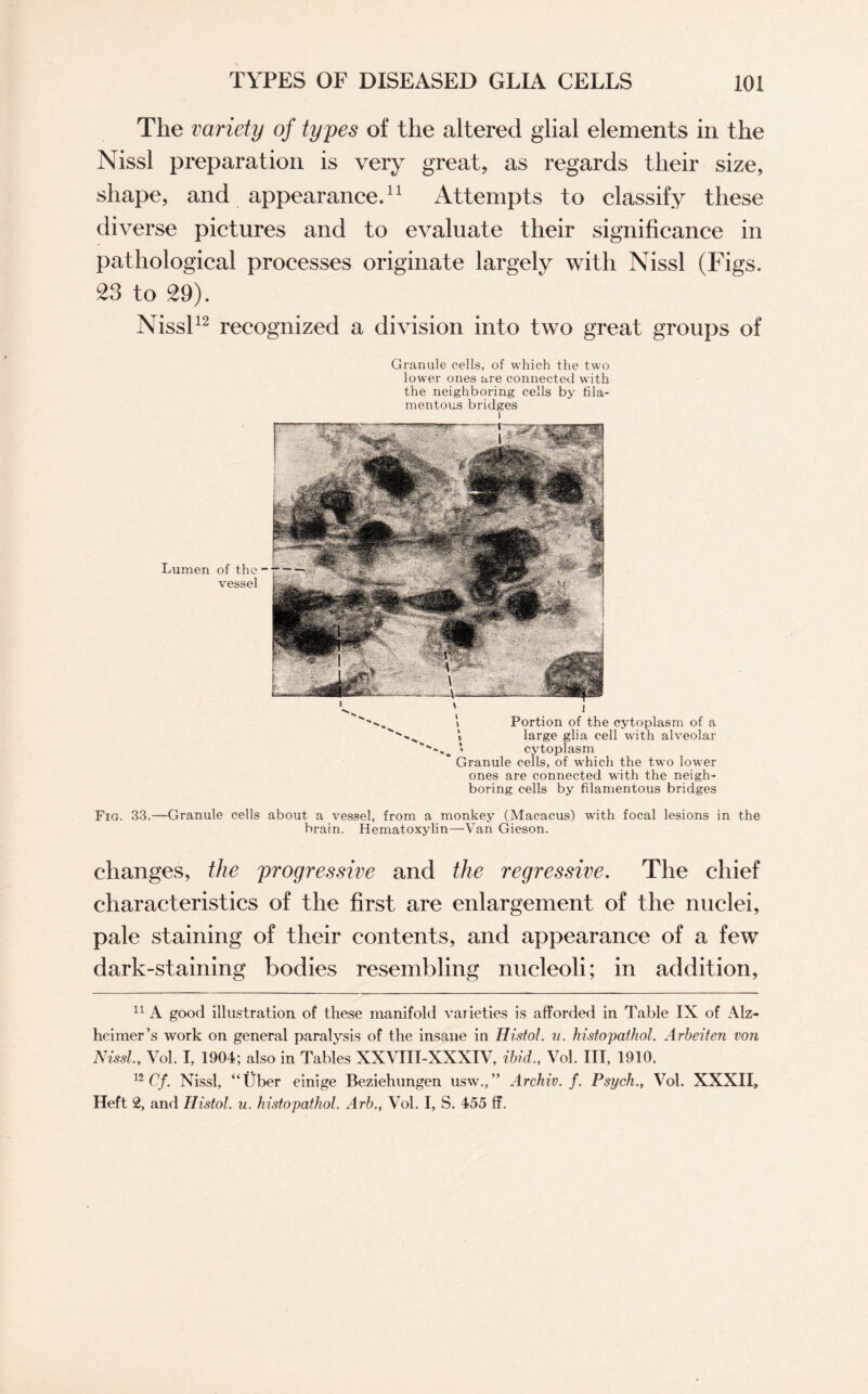 The variety of types of the altered glial elements in the Nissl preparation is very great, as regards their size, shape, and appearance.11 Attempts to classify these diverse pictures and to evaluate their significance in pathological processes originate largely with Nissl (Figs. 23 to 29). Nissl12 recognized a division into two great groups of Lumen of the vessel Granule cells, of which the two lower ones are connected with the neighboring cells by fila¬ mentous bridges i l i Portion of the cytoplasm of a \ large glia cell with alveolar cytoplasm Granule cells, of which the two lower ones are connected with the neigh¬ boring cells by filamentous bridges Fig. 33.—Granule cells about a vessel, from a monkey (Macacus) with focal lesions in the brain. Hematoxylin—Van Gieson. changes, the progressive and the regressive. The chief characteristics of the first are enlargement of the nuclei, pale staining of their contents, and appearance of a few dark-staining bodies resembling nucleoli; in addition, 11 A good illustration of these manifold varieties is afforded in Table IX of Alz¬ heimer’s work on general paralysis of the insane in Histol. u. histopathol. Arbeiten von Nissl., Vol. I, 1904; also in Tables XXVIII-XXXIV, ibid., Vol. Ill, 1910. 12 Cf. Nissl, “Uber einige Beziehungen usw.,” Archiv. f. Psych., Vol. XXXII, Heft 2, and Histol. u. histopathol. Arb., Vol. I, S. 455 ff.