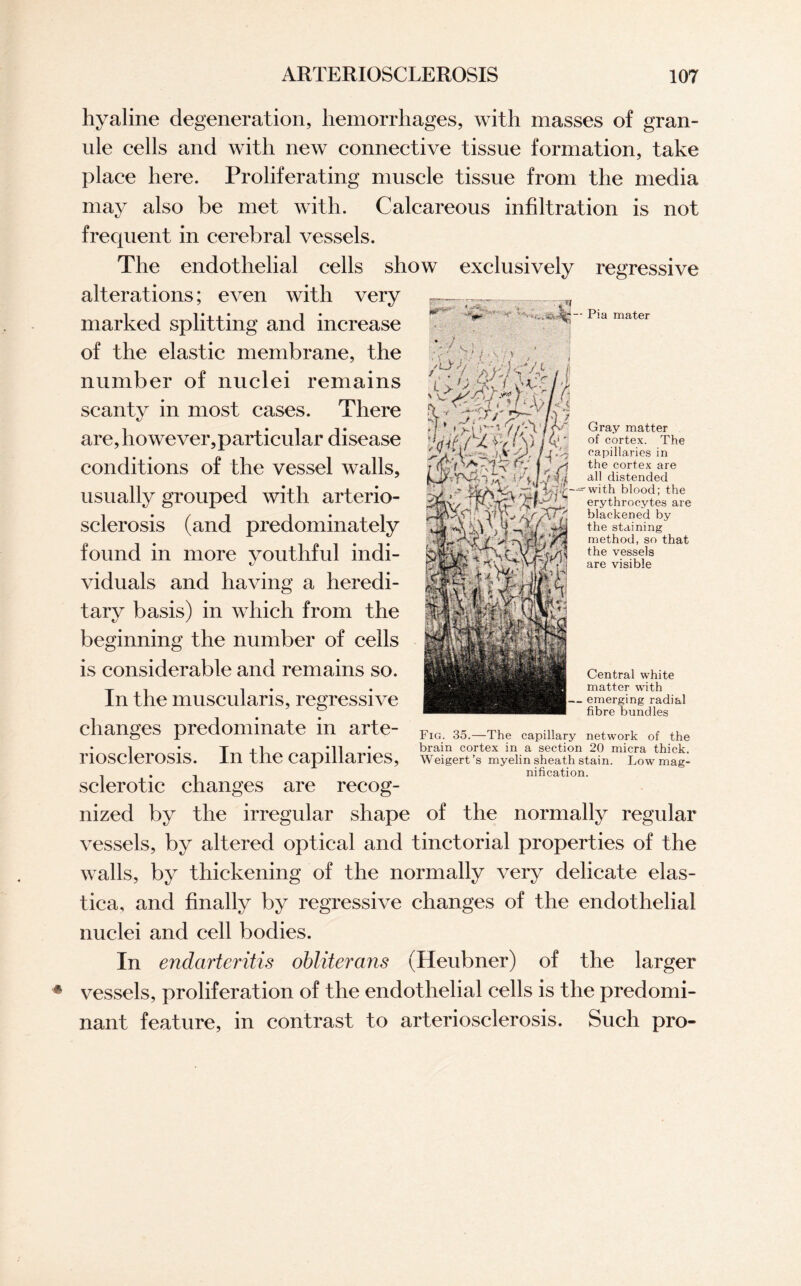 pr-' ■ * Pia mater 7 .'LW/ * A i • •. . / XL, , % < Tsr>~C > J * t vi r - 7/ -1,7 <v Gray matter >w>/*&W i The hyaline degeneration, hemorrhages, with masses of gran- nle cells and with new connective tissue formation, take place here. Proliferating muscle tissue from the media may also be met with. Calcareous infiltration is not frequent in cerebral vessels. The endothelial cells show exclusively regressive alterations; even with very marked splitting and increase of the elastic membrane, the number of nuclei remains scanty in most cases. There are, however,particular disease conditions of the vessel walls, usually grouped with arterio¬ sclerosis (and predominately found in more youthful indi¬ viduals and having a heredi¬ tary basis) in which from the beginning the number of cells is considerable and remains so. In the muscularis, regressive changes predominate in arte- Flo. 35._The capillary network of the • 1 • T xl •ii brain cortex in a section 20 micra thick. l’losclerosis. In tile capillaries, Weigert’s myelin sheath stain. Low mag- 7 . , nification. sclerotic changes are recog¬ nized by the irregular shape of the normally regular vessels, by altered optical and tinctorial properties of the walls, by thickening of the normally very delicate elas- tica, and finally by regressive changes of the endothelial nuclei and cell bodies. In endarteritis obliterans (Heubner) of the larger vessels, proliferation of the endothelial cells is the predomi¬ nant feature, in contrast to arteriosclerosis. Such pro- capillaries in the cortex are all distended ^M-witkbloo?; the <r-rv / t-~' erythrocytes are blackened by the staining method, so that the vessels are visible Central white matter with — emerging radial fibre bundles