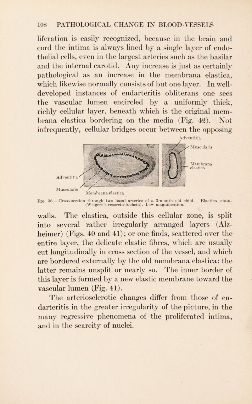 liferation is easily recognized, because in the brain and cord the intima is always lined by a single layer of endo¬ thelial cells, even in the largest arteries such as the basilar and the internal carotid. Any increase is just as certainly pathological as an increase in the membrana elastica, which likewise normally consists of but one layer. In well- developed instances of endarteritis obliterans one sees the vascular lumen encircled by a uniformly thick, richly cellular layer, beneath which is the original mem- brana elastica bordering on the media (Fig. 42). Not infrequently, cellular bridges occur between the opposing Adventitia Adventitia Muscularis Membrana elastica Muscularis Membrana elastica Fig. 36.—Cross-section through two basal arteries of a 3-month old child. Elastica stain. (Weigert’s resorcin-fuchsin). Low magnification. walls. The elastica, outside this cellular zone, is split into several rather irregularly arranged layers (Alz¬ heimer) (Figs. 40 and 41); or one finds, scattered over the entire layer, the delicate elastic fibres, which are usually cut longitudinally in cross section of the vessel, and which are bordered externally by the old membrana elastica; the latter remains unsplit or nearly so. The inner border of this layer is formed by a new elastic membrane toward the vascular lumen (Fig. 41). The arteriosclerotic changes differ from those of en¬ darteritis in the greater irregularity of the picture, in the many regressive phenomena of the proliferated intima, and in the scarcity of nuclei.