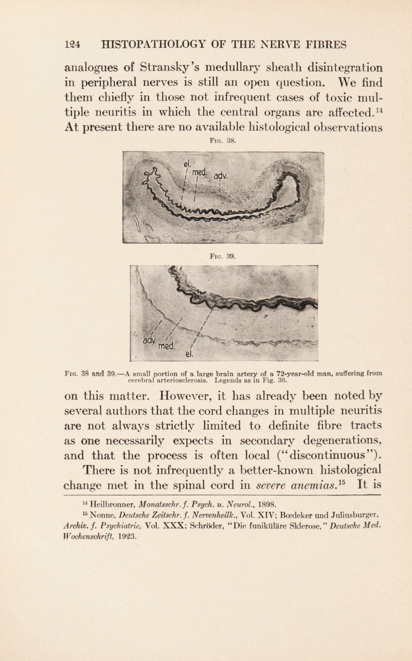 analogues of Stransky’s medullary sheath disintegration in peripheral nerves is still an open question. We find them chiefly in those not infrequent cases of toxic mul¬ tiple neuritis in which the central organs are affected.14 At present there are no available histological observations Fig. 38. Fig. 39. Fig. 38 and 39.—A small portion of a large brain artery of a 72-year-old man, suffering from cerebral arteriosclerosis. Legends as in Fig. 36. on this matter. However, it has already been noted by several authors that the cord changes in multiple neuritis are not always strictly limited to definite fibre tracts as one necessarily expects in secondary degenerations, and that the process is often local (“discontinuous”). There is not infrequently a better-known histological change met in the spinal cord in severe anemias.15 it is 14 Heilbronner, Monatsschr. f. Psych, u. Neurol., 1898. 15 Nonne, Deutsche Zeitschr. f. Nervenheilk., Vol. XIV; Boedeker und Juliusburger, Archiv. f. Psychiatrie, Vol. XXX; Schroder, “Die funikiilare Sklerose,” Deutsche Med. Wochenschrift, 1923.