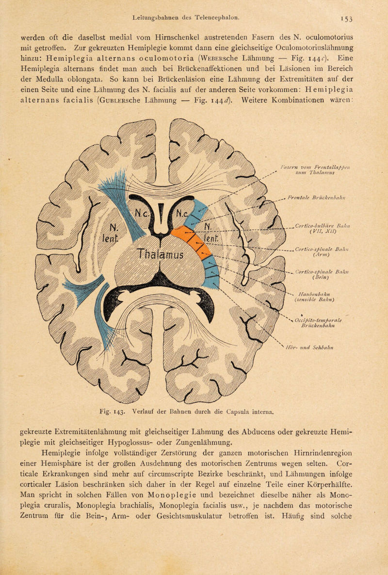 werden oft die daselbst medial vom Hirnschenkel austretenden Fasern des N. oculomotorius mit getroffen. Zur gekreuzten Hemiplegie kommt dann eine gleichseitige Oculomotoriuslähmung hinzu: Hemiplegia alternans oculomotoria (WEBERsche Lähmung — Fig. 144c). Eine Hemiplegia alternans findet man auch bei Brückenaffektionen und bei Läsionen im Bereich der Medulla oblongata. So kann bei Brückenläsion eine Lähmung der Extremitäten auf der einen Seite und eine Lähmung des N. facialis auf der anderen Seite Vorkommen: Hemiplegia alternans facialis (GuBLERsche Lähmung — Fig. 144d). Weitere Kombinationen wären: Fasern vom Fro7itallappen zum Thalamus Frontale Brückenbahn _Cortico-bulbäre Bahn (VII, XII) -- Cortico-spmale Balm (Arm ) Cortico-spinale Bahn (Bein ) Haubenbahn (sensible Balm) S Occipito-temporale Brücke7ibahn Hör- und Sehbalm Fig. 143. Verlauf der Bahnen durch die Capsula interna. gekreuzte Extremitätenlähmung mit gleichseitiger Lähmung des Abducens oder gekreuzte Hemi¬ plegie mit gleichseitiger Hypoglossus- oder Zungenlähmung. Hemiplegie infolge vollständiger Zerstörung der ganzen motorischen Hirnrindenregion einer Hemisphäre ist der großen Ausdehnung des motorischen Zentrums wegen selten. Cor- ticale Erkrankungen sind mehr auf circumscripte Bezirke beschränkt, und Lähmungen infolge corticaler Läsion beschränken sich daher in der Regel auf einzelne Teile einer Körperhälfte. Man spricht in solchen Fällen von Monoplegie und bezeichnet dieselbe näher als Mono- plegia cruralis, Monoplegia brachialis, Monoplegia facialis usvv., je nachdem das motorische Zentrum für die Bein-, Arm- oder Gesichtsmuskulatur betroffen ist. Häufig sind solche