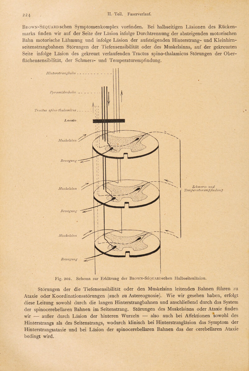 Brown-Sequard sehen Symptomenkomplex vorfinden. Bei halbseitigen Läsionen des Rücken¬ marks finden wir auf der Seite der Läsion infolge Durchtrennung der absteigenden motorischen Bahn motorische Lähmung und infolge Läsion der aufsteigenden Hinterstrang- und Kleinhirn¬ seitenstrangbahnen Störungen der Tiefensensibilität oder des Muskelsinns, auf der gekreuzten Seite infolge Läsion des gekreuzt verlaufenden Tractus spino-thalamicus Störungen der Ober¬ flächensensibilität, der Schmerz- und Temperaturempfindung. Hinterstrangbahn . Pyramidenbahn Tractus spino- thalamicus Laesio Muskelsinn Bewegtui' M?iskelsi?m Bewegung Muskelsinn Bewegung Schmerz- und Temper atu?-empfindung \ Fig. 202. Schema zur Erklärung der BROWN-SEQUARDschen Halbseitenläsion. Störungen der die Tiefen Sensibilität oder den Muskelsinn leitenden Bahnen führen zu Ataxie oder Koordinationsstörungen (auch zu Astereognosie). Wie wir gesehen haben, erfolgt diese Leitung sowohl durch die langen Hinterstrangbahnen und anschließend durch das System der spinocerebellaren Bahnen im Seitenstrang. Störungen des Muskelsinns oder Ataxie finden wir — außer durch Läsion der hinteren Wurzeln — also auch bei Affektionen sowohl des Hinterstrangs als des Seitenstrangs, wodurch klinisch bei Hinterstrangläsion das Symptom der Hinterstrangsataxie und bei Läsion der spinocerebellaren Bahnen das der cerebellaren Ataxie bedingt wird.