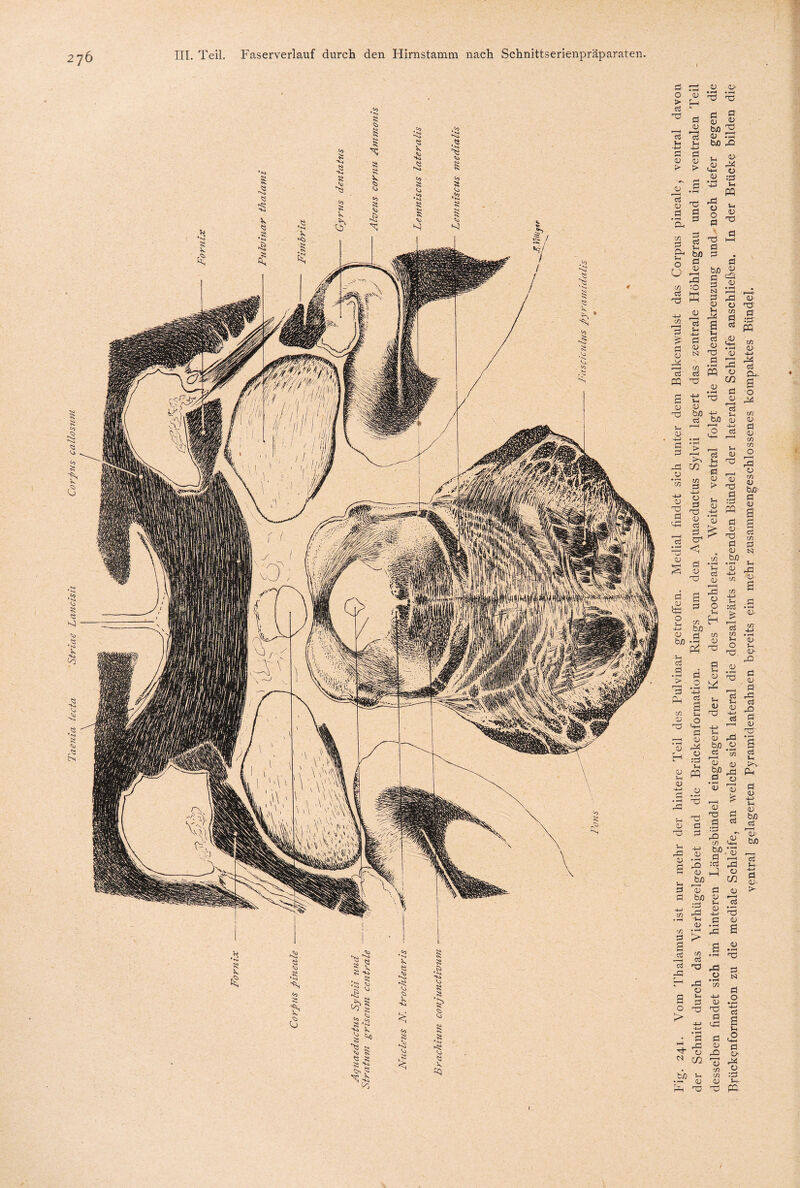 Taenia tecta String Lancisu Corpus callosuM > 13 y y > > <u ff d d I § t/J -O - ^ d 2$ y N d' d El Ui y OJ y- y 02 2 s d 51 ff < y <3 y ff .y #y y tuo y 24 U-< y • *—4 4-) Ul y 0 Ui y # y y 3 y 0 Ui 24 ä Ui y PP y 02 y y 1 b/> y Ul <v PP ’S Cu 24 y y r- - 4 23 y ba d 5ff o I—< •2—» (LJ b/) s d t/3 bfl d ffi Cu d 2 ff ö ff -2 3 4-> Cu ^ „ a tn Ui y o ff <4-1 d ff y 'y 24 y ff ff Ui 2 w y d .a 3 ^ u. ff d d y 1—I ff y o Ui H t/3 y ff d y ff d y bß y u> tn tn u :d > ca 2 tn .4 »? a O u ff <1 y y ff y a Ui d d tn d a cä c3 -a s o > W f u. g i ff ü i * a u . ^ y ff *: bß y 5 d -35 « y y : ^ ff p .5 ° w 1 S £ 1 y ff y jbß T> bo Ul y • M > tn d ff ff y Ui d ff y ff d :d ff tn bJO ' d :d u d d y UH y r 4 ff y 02 y 13 ff y s d y d *2 • t-H y ^ d y Ui y y bo d Ui U-u d y- !>- • d t y ^ 02 £ ff ff y ff d ff d y ff r—H <L> t/3 t/3 aj .2 s 5-t £ d y 24 y • 1—* pq.