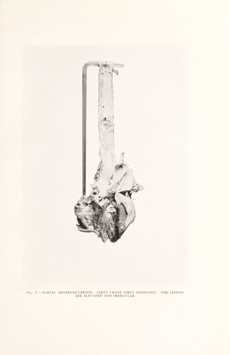 Fig. 5.—AORTIC ARTERIOSCLEROSIS. SARUS CRANE (GRUS ANTIGONE). THE LESIONS ARE ELEVATED AND IRREGULAR.