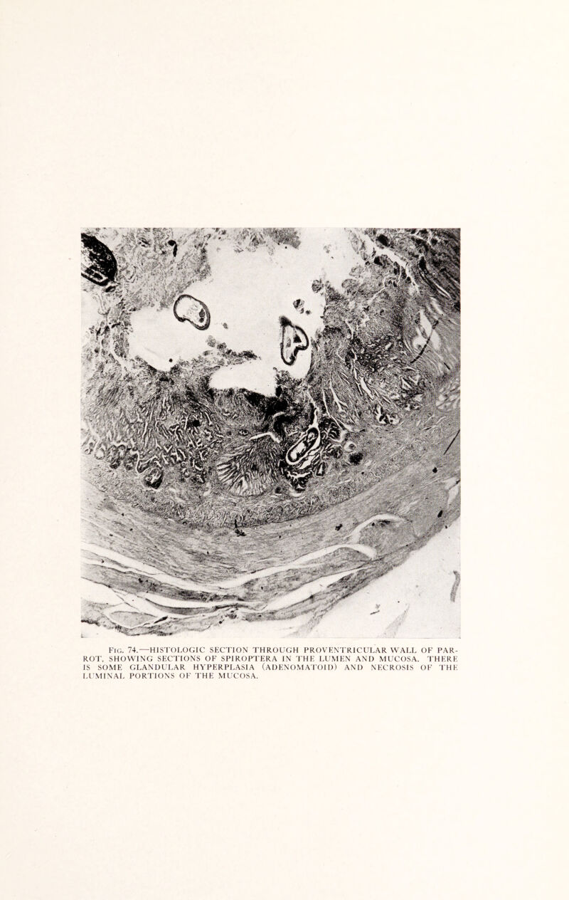 Fig. 74.—HISTOLOGIC SECTION THROUGH PROVENTRICULAR WALL OF PAR- ROT, SHOWING SECTIONS OF SPIROPTERA IN THE LUMEN AND MUCOSA. THERE IS SOME GLANDULAR HYPERPLASIA (ADENOMATOID) AND NECROSIS OF THE LUMINAL PORTIONS OF THE MUCOSA.