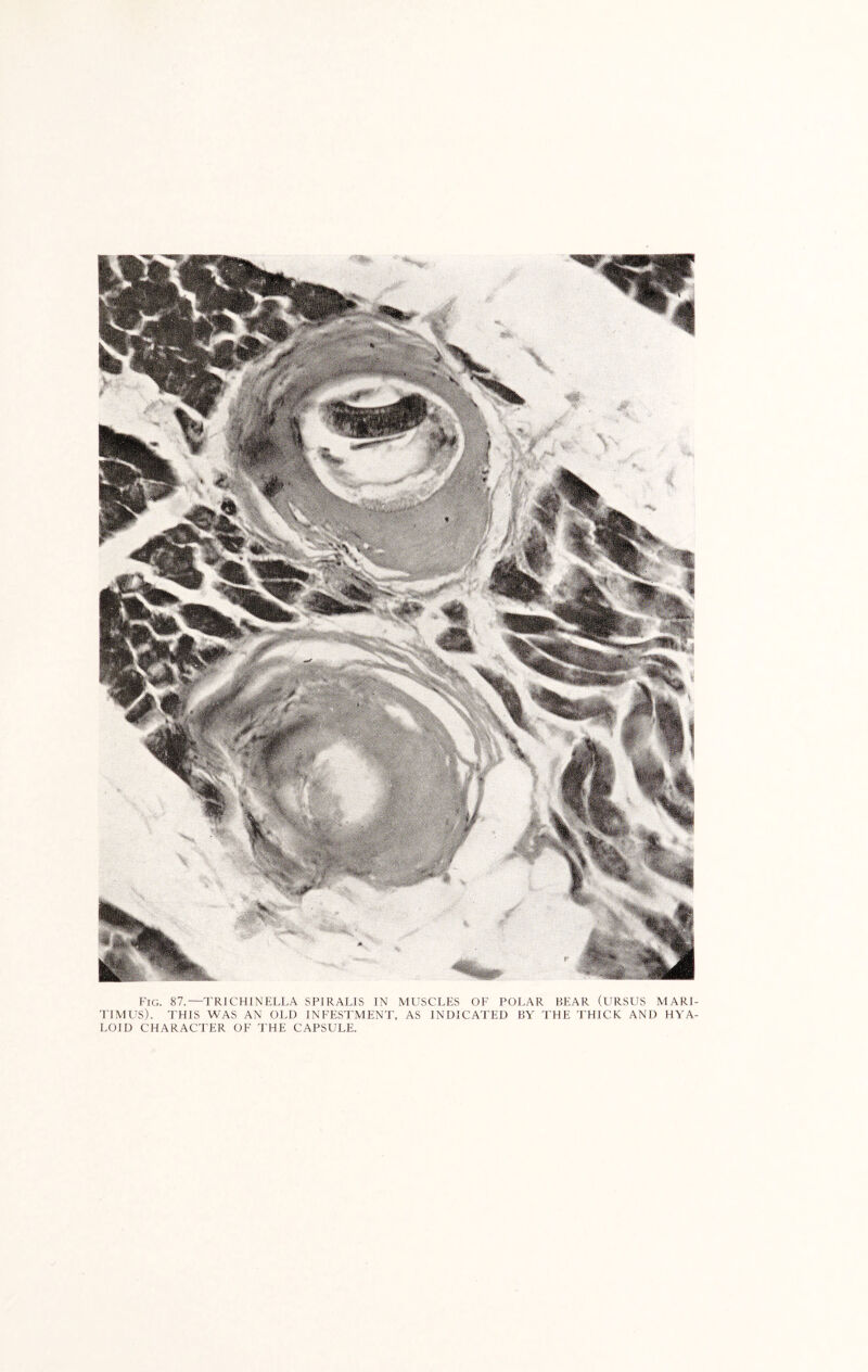 Fig. 87.—TRICHINELLA SPIRALIS IN MUSCLES OF POLAR BEAR (URSUS MARI- TIMUS). THIS WAS AN OLD INFESTMENT, AS INDICATED BY THE THICK AND HYA- LOID CHARACTER OF THE CAPSULE.