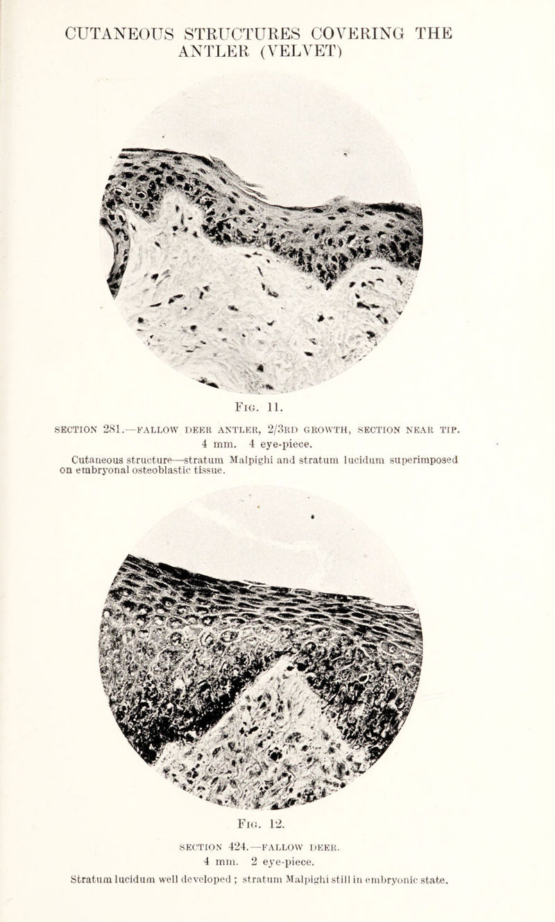 ANTLER (VELVET) Fig. 11. SECTION 281.—FALLOW DEER ANTLER, 2/3RD GROWTH, SECTION NEAR TIP. 4 mm. 4 eye-piece. Cutaneous structure—stratum Malpighi and stratum lucidum superimposed on embryonal osteoblastic tissue. Fig. 12. SECTION 424.—FALLOW DEER. 4 mm. 2 eye-piece. Stratum lucidum well developed ; stratum Malpighi still in embryonic state.