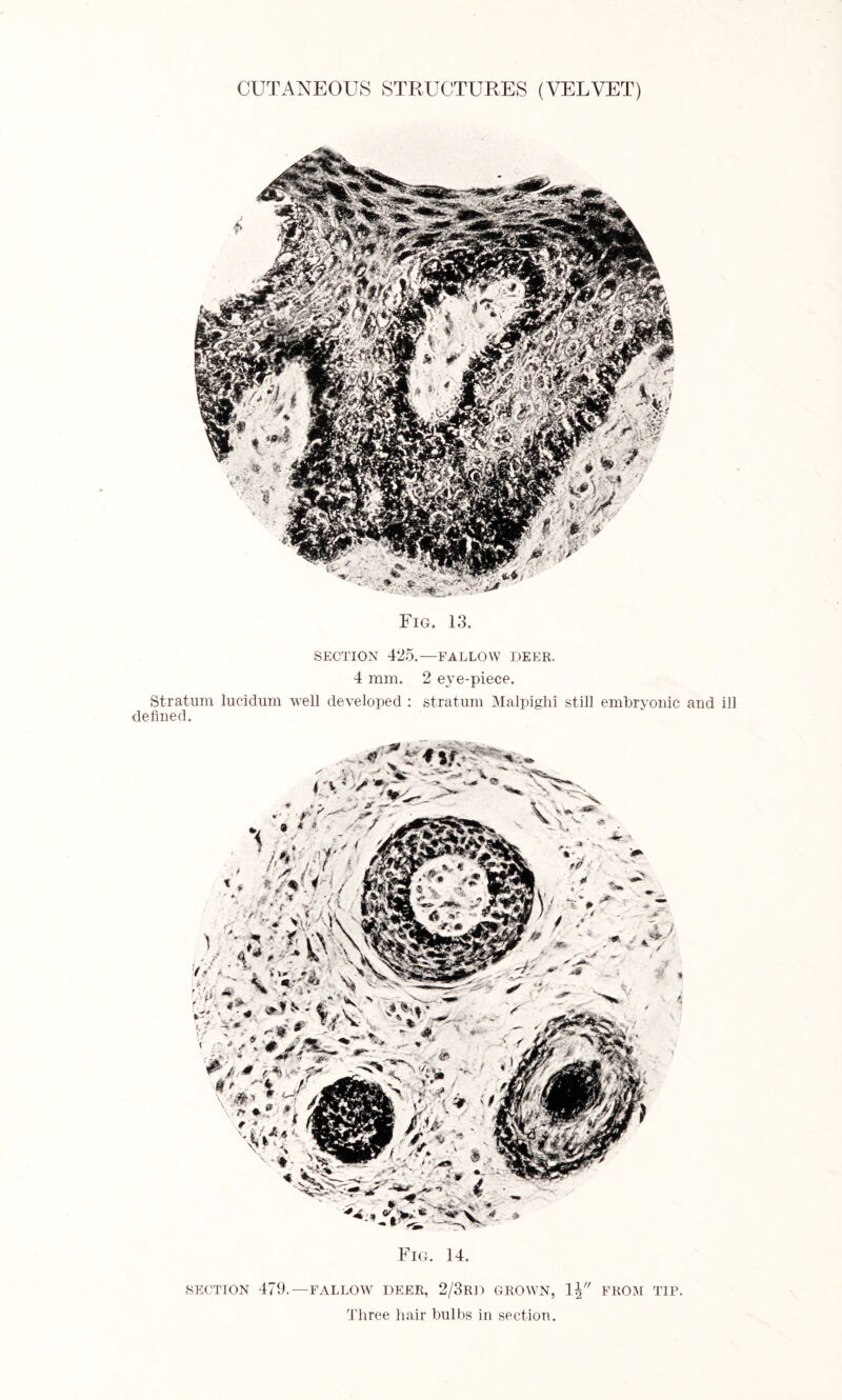 Fig. 13. SECTION 425.—FALLOW DEER. 4 mm. 2 eye-piece. Stratum lucidum well developed : stratum Malpighi still embryonic and ill defined. Fig. 14. SECTION 479.—FALLOW DEER, 2/3RD GROWN, 1\ FROM TIP. Three hair bulbs in section.