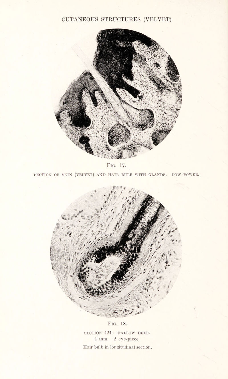 Fig. 17. SECTION OF SKIN (VELVET) AND HAIR BULB WITH GLANDS. LOW POWER. SECTION 424.—FALLOW DEER. 4 mm. 2 eje-piece. Hair buib in longitudinal section.