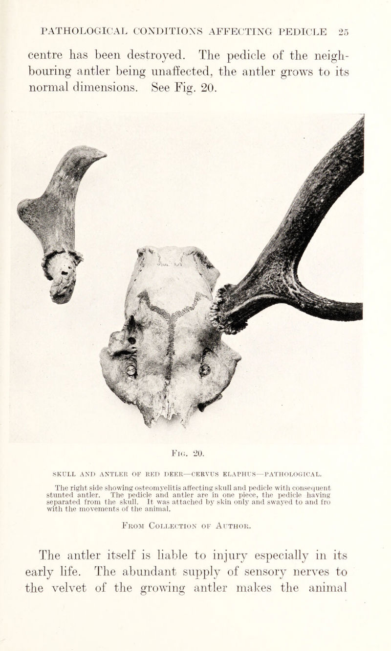 centre lias been destroyed. The pedicle of the neigh- bouring antler being unaffected, the antler grows to its normal dimensions. See Fig. 20. Fig. 20. SKULL AND ANTLER OF RED DEER—CERVUS ELAPHUS— PATHOLOGICAL. The right side showing osteomyelitis affecting skull and pedicle with consequent stunted antler. The pedicle and antler are in one piece, the pedicle having separated from the skull. It was attached by skin only and swayed to and fro with the movements of the animal. From Collection of Author. The antler itself is liable to injury especially in its early life. The abundant supply of sensory nerves to the velvet of the growing antler makes the animal