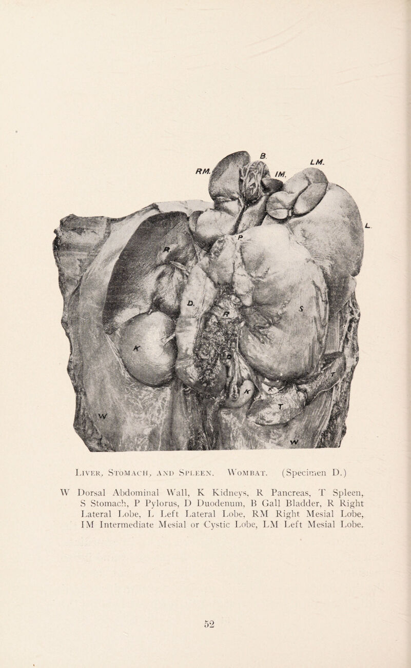 Liver, Stomach, and Spleen. Wombat. (Specimen D.) W Dorsal Abdominal Wall, K Kidneys, R Pancreas, T Spleen, S Stomach, P Pylorus, D Duodenum, B Gall Bladder, R Right Lateral Lobe, L Left Lateral Lobe, RM Right Mesial Lobe, IM Intermediate Mesial or Cystic Lobe, LM Left Mesial Lobe. -v