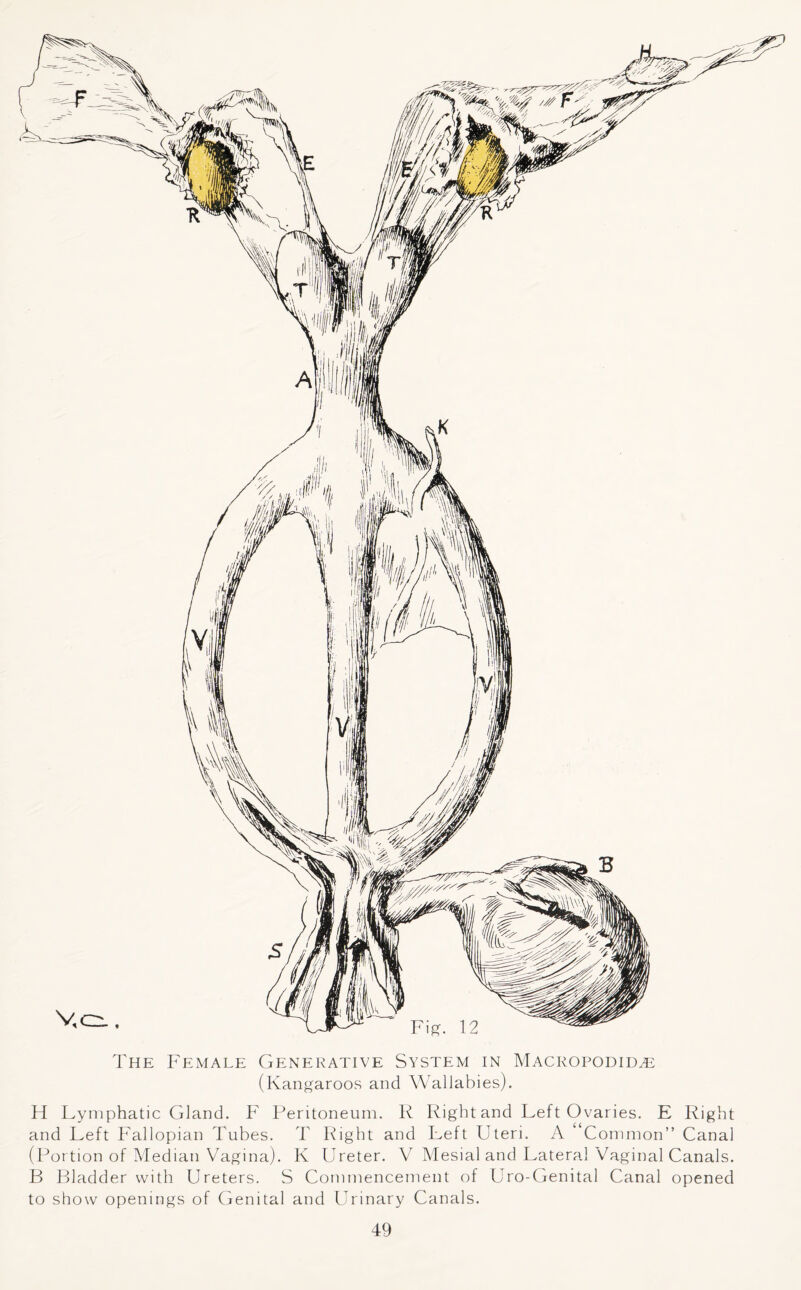 The Female Generative System in Macropodiile (Kangaroos and Wallabies). H Lymphatic Gland. F Peritoneum. R Right and Left Ovaries. E Right and Left Fallopian Tubes. T Fight and Left Uteri. A “Common” Canal (Portion of Median Vagina). K Ureter. V Mesial and Lateral Vaginal Canals. B Bladder with Ureters. S Commencement of Uro-Genital Canal opened to show openings of Genital and Urinary Canals.