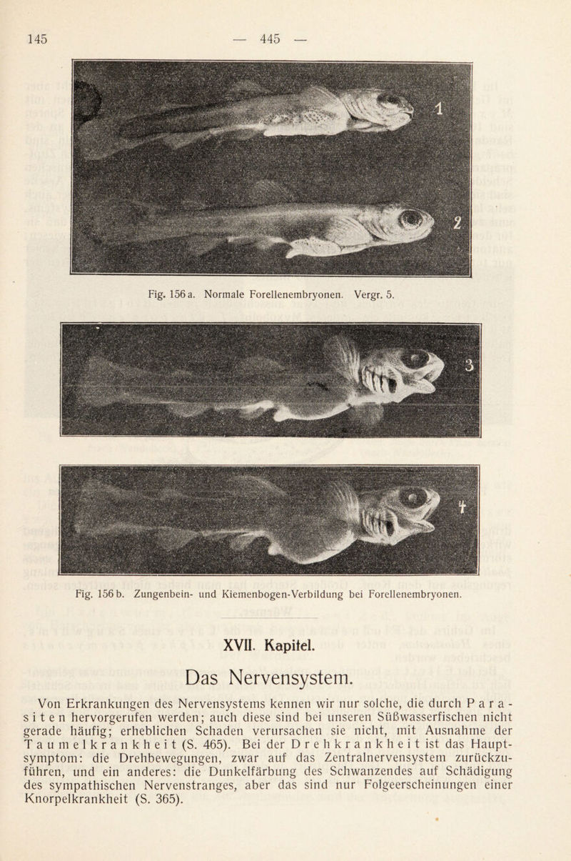 Fig. 156 a. Normale Forellenembryonen. Vergr. 5. Fig. 156 b. Zungenbein- und Kiemenbogen-Verbildung bei Forellenembryonen. XVII. Kapitel. Das Nervensystem. Von Erkrankungen des Nervensystems kennen wir nur solche, die durch Para- s i t e n hervorgerufen werden; auch diese sind bei unseren Siibwasserfischen nicht gerade haufig; erheblichen Schaden verursachen sie nicht, mit Ausnahme der Taumelkrankheit (S. 465). Bei der Drehkrankheit ist das Haupt- symptom: die Drehbewegungen, zwar auf das Zentralnervensystem zuriickzu- ftihren, und ein anderes: die Dunkelfarbung des Schwanzendes auf Schadigung des sympathischen Nervenstranges, aber das sind nur Folgeerscheinungen einer Knorpelkrankheit (S. 365). *