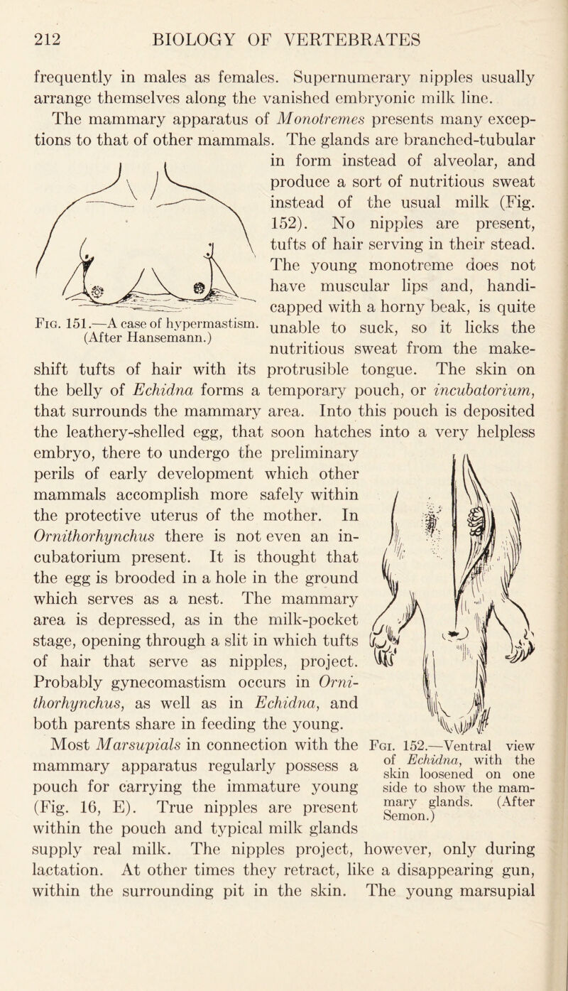 frequently in males as females. Supernumerary nipples usually arrange themselves along the vanished embryonic milk line. The mammary apparatus of Monotrernes presents many excep- tions to that of other mammals. The glands are branched-tubular in form instead of alveolar, and produce a sort of nutritious sweat instead of the usual milk (Fig. 152). No nipples are present, tufts of hair serving in their stead. The young monotrcme does not have muscular lips and, handi- capped with a horny beak, is quite Fw. i51 .—A ease °f liypCTma^tism. unable to suck, so it licks the (Alter Hansemann.) nutritious sweat irom the make- shift tufts of hair with its protrusible tongue. The skin on the belly of Echidna forms a temporary pouch, or incubatorium, that surrounds the mammary area. Into this pouch is deposited the leathery-shelled egg, that soon hatches into a very helpless embryo, there to undergo the preliminary perils of early development which other mammals accomplish more safely within the protective uterus of the mother. In Ornithorhynchus there is not even an in- cubafcorium present. It is thought that the egg is brooded in a hole in the ground which serves as a nest. The mammary area is depressed, as in the milk-pocket f stage, opening through a slit in which tufts of hair that serve as nipples, project. Probably gynecomastism occurs in Orni- thorhynchus, as well as in Echidna, and both parents share in feeding the young. Most Marsupials in connection with the Fgi. 152.—Ventral mammary apparatus regularly possess a pouch for carrying the immature young (Fig. 16, E). True nipples are present within the pouch and typical milk glands supply real milk. The nipples project, however, only during lactation. At other times they retract, like a disappearing gun, within the surrounding pit in the skin. The young marsupial view of Echidna, with the skin loosened on one side to show the mam- mary glands. (After Semon.)