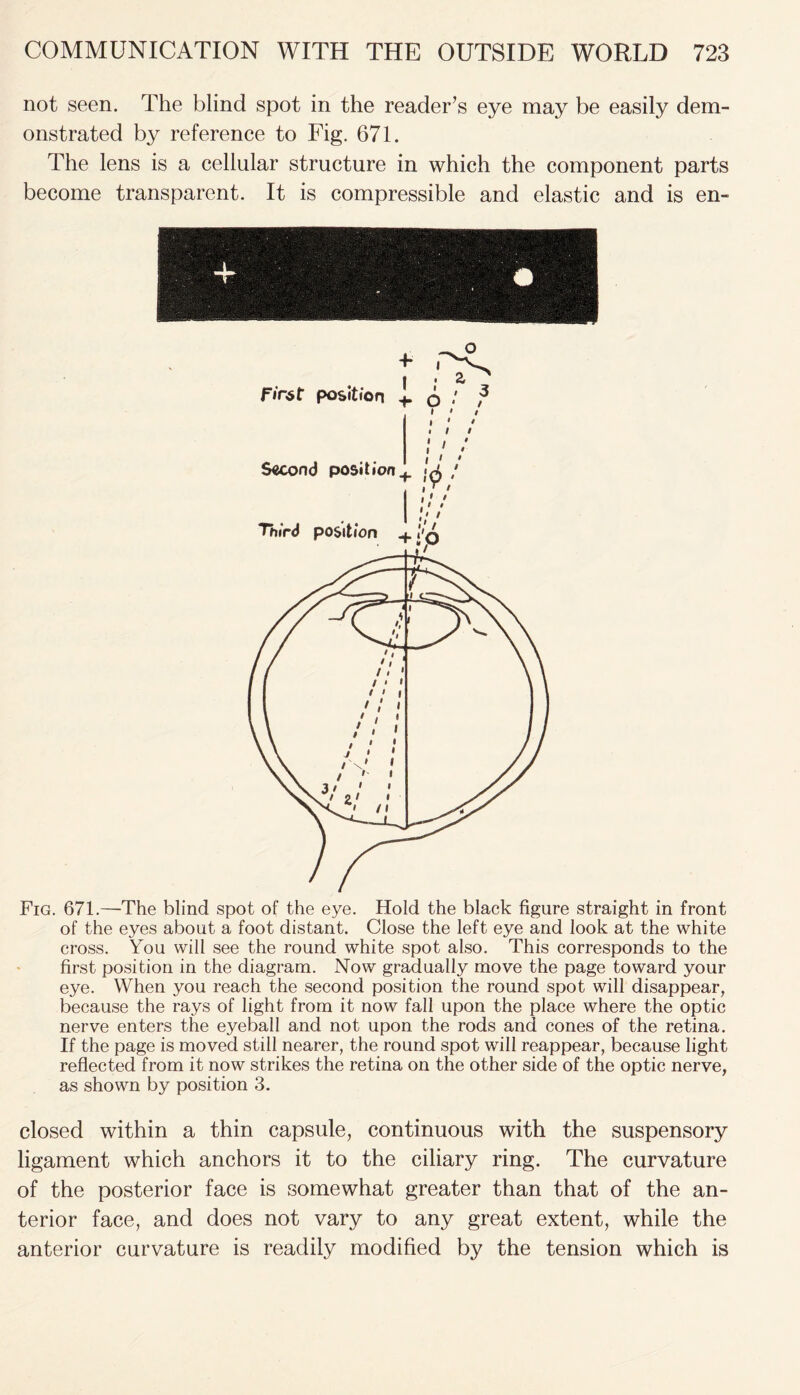 not seen. The blind spot in the reader’s eye may be easily dem- onstrated by reference to Fig. 671. The lens is a cellular structure in which the component parts become transparent. It is compressible and elastic and is en- Fig. 671.—The blind spot of the eye. Hold the black figure straight in front of the eyes about a foot distant. Close the left eye and look at the white cross. You will see the round white spot also. This corresponds to the first position in the diagram. Now gradually move the page toward your eye. When you reach the second position the round spot will disappear, because the rays of light from it now fall upon the place where the optic nerve enters the eyeball and not upon the rods and cones of the retina. If the page is moved still nearer, the round spot will reappear, because light reflected from it now strikes the retina on the other side of the optic nerve, as shown by position 3. closed within a thin capsule, continuous with the suspensory ligament which anchors it to the ciliary ring. The curvature of the posterior face is somewhat greater than that of the an- terior face, and does not vary to any great extent, while the anterior curvature is readily modified by the tension which is