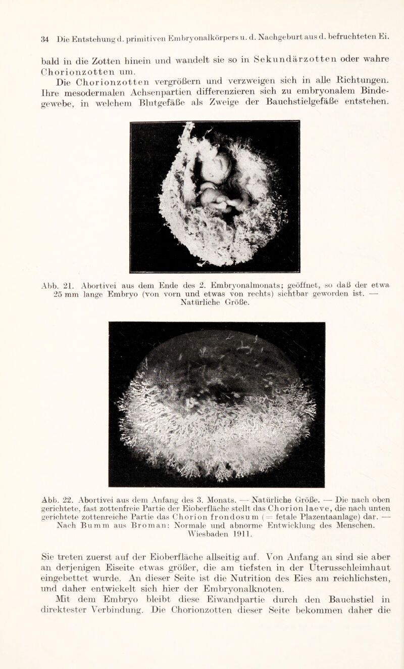 bald in die Zotten hinein und wandelt sie so in Sekundärzotten oder wahre Chorionzotten um. Die Chorionzotten vergrößern und verzweigen sich in alle Richtungen. Ihre mesodermalen Achsenpartien differenzieren sich zu embryonalem Binde- gewebe, in welchem Blutgefäße als Zweige der Bauchstielgefäße entstehen. Abb. 21. Abortivei aus dem Ende des 2. Embryonalmonats; geöffnet, so daß der etwa 25 mm lange Embryo (von vorn und etwas von rechts) sichtbar geworden ist. — Natürliche Größe. Abb. 22. Abortivei aus dem Anfang des 3. Monats. — Natürliche Größe. ■— Die nach oben gerichtete, fast zottenfreie Partie der Eioberfläche stellt das Chorion laeve, die nach unten gerichtete zottenreiche Partie das Chorion frondos um fetale Plazentaanlage) dar. — Nach Bumra aus Brom an: Normale und abnorme Entwicklung des Menschen. Wiesbaden 1911. Sie treten zuerst auf der Eioberfläche allseitig auf. Von Airfang an sind sie aber an derjenigen Eiseite etwas größer, die am tiefsten in der Uterusschleimhaut eingebettet wurde. An dieser Seite ist die Nutrition des Eies am reichlichsten, und daher entwickelt sich hier der Embryonalknoten. Mit dem Embryo bleibt diese Eiwandpartie durch den Bauchstiel in direktester Verbindung. Die Chorionzotten dieser Seite bekommen daher die