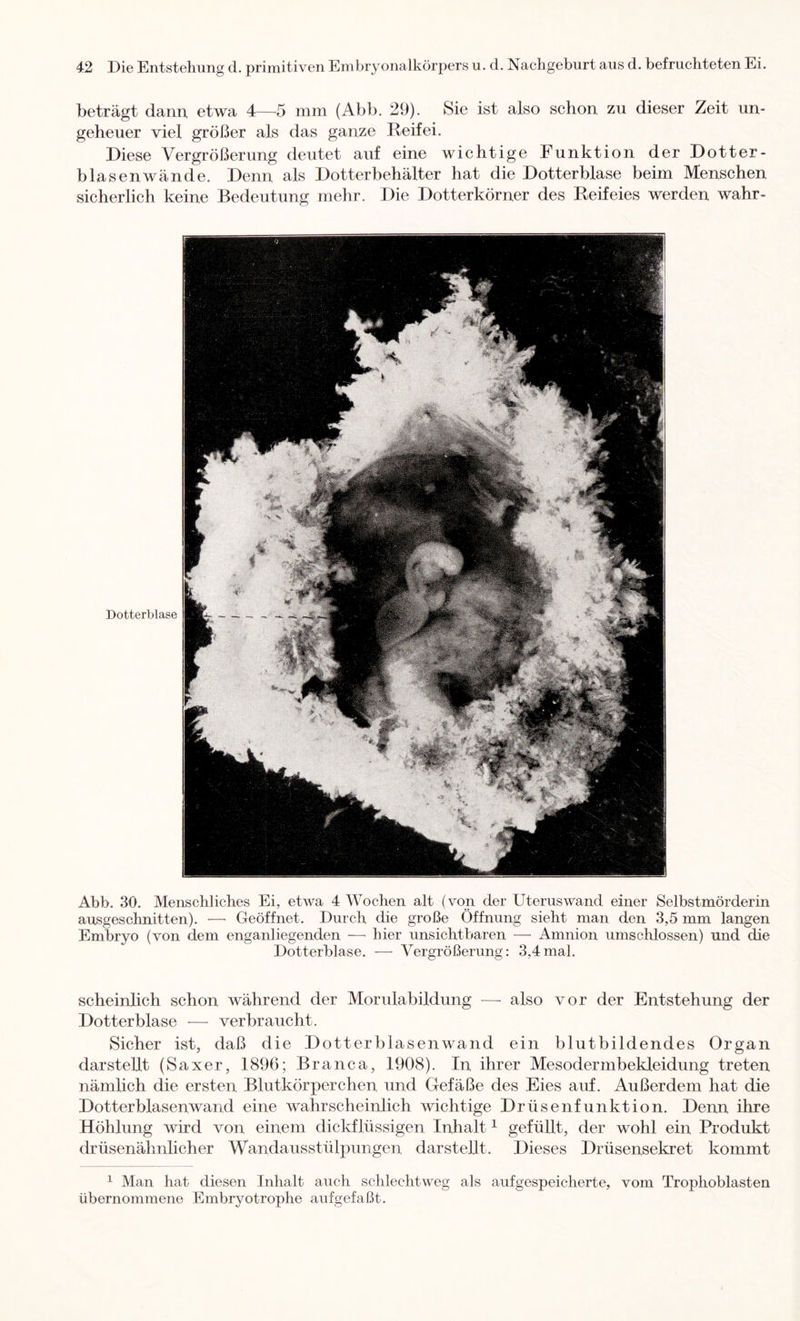 beträgt dann, etwa 4—5 mm (Abb. 29). Sie ist also schon zu dieser Zeit un- geheuer viel größer als das ganze Deifei. Diese Vergrößerung deutet auf eine wichtige Funktion der Dotter- blasenwände. Denn als Dotterbehälter hat die Dotter blase beim Menschen sicherlich keine Bedeutung mehr. Die Dotterkörner des Reifeies werden wahr- Dotterblase Abb. 30. Menschliches Ei, etwa 4 Wochen alt (von der Uteruswand einer Selbstmörderin ausgeschnitten). ■—• Geöffnet. Durch die große Öffnung sieht man den 3,5 mm langen Embryo (von dem enganliegenden —■ hier unsichtbaren — Amnion umschlossen) und die Dotterblase. — Vergrößerung: 3,4mal. scheinlich schon während der Morulabildung — also vor der Entstehung der Dotter blase — verbraucht. Sicher ist, daß die Dotterblasenwand ein blutbildendes Organ darstellt (Saxer, 1896; Branca, 1908). In ihrer Mesodermbekleidung treten nämlich die ersten Blutkörperchen und Gefäße des Eies auf. Außerdem hat die Dotter blasenwand eine wahrscheinlich wichtige Drüsenfunktion. Denn ihre Höhlung wird von einem dickflüssigen Inhalt ^ gefüllt, der wohl ein Produkt drüsenähnlicher Wandausstülpungen dar stellt. Dieses Drüsensekret kommt 1 Man hat diesen Inhalt auch schlechtweg als aufgespeicherte, vom Trophoblasten übernommene Embryotrophe aufgefaßt.