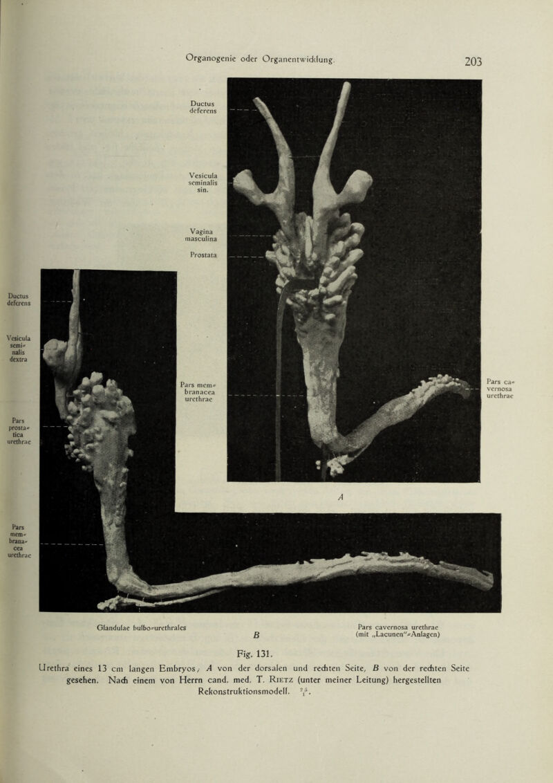 Ductus defcrens Vesicula semi- nalis dextra Pars prosta* tica urethrae Pars mem-- brana* cea urethrae Ductus deferens Vesicula seminalis sin. Vagina niasculina Prostata Pars ca= vernosa urethrae Glandulae bulbo-urcthrales Pars cavernosa urethrae B (mit ,,Lacunen-Anlagen) Fig. 131. Urethra eines 13 cm langen Embryos,- A von der dorsalen und rechten Seite, B von der rechten Seite gesehen. Nach einem von Herrn cand. med. T. Rietz (unter meiner Leitung) hergestellten Rekonstruktionsmodell. 2,5.