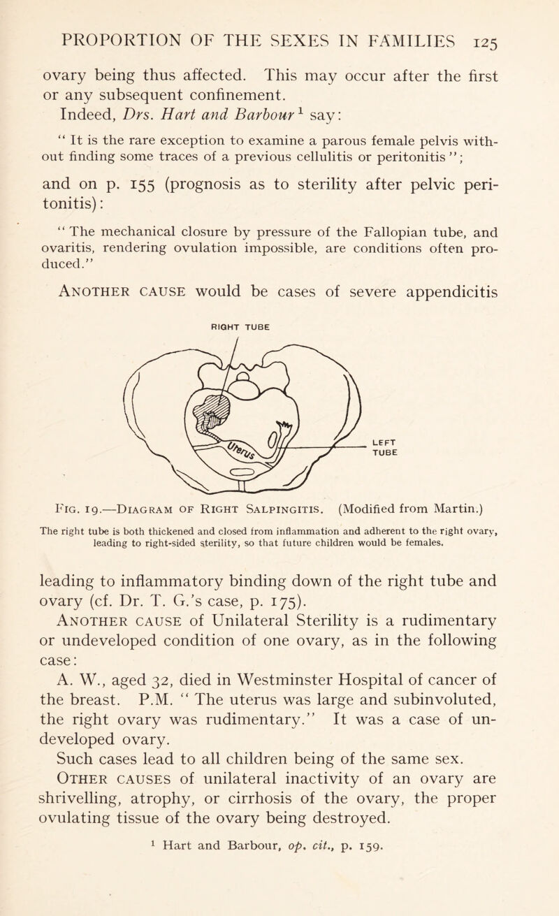 ovary being thus affected. This may occur after the first or any subsequent confinement. Indeed, Drs. Hart and Barbour ^ say: “ It is the rare exception to examine a parous female pelvis with- out finding some traces of a previous cellulitis or peritonitis”; and on p. 155 (prognosis as to sterility after pelvic peri- tonitis) : “The mechanical closure by pressure of the Fallopian tube, and ovaritis, rendering ovulation impossible, are conditions often pro- duced.” Another cause would be cases of severe appendicitis RIGHT TUBE left TUBE Fig. 19.—Diagram of Right Salpingitis. (Modified from Martin.) The right tube is both thickened and closed from inflammation and adherent to the right ovary, leading to right-sided sterility, so that future children would be females. leading to inflammatory binding down of the right tube and ovary (cf. Dr. T. G.’s case, p. 175). Another cause of Unilateral Sterility is a rudimentary or undeveloped condition of one ovary, as in the following case: A. W., aged 32, died in Westminster Hospital of cancer of the breast. P.M. “ The uterus was large and subinvoluted, the right ovary was rudimentary.” It was a case of un- developed ovary. Such cases lead to all children being of the same sex. Other causes of unilateral inactivity of an ovary are shrivelling, atrophy, or cirrhosis of the ovary, the proper ovulating tissue of the ovary being destroyed. 1 Hart and Barbour, op. cit., p. 159.