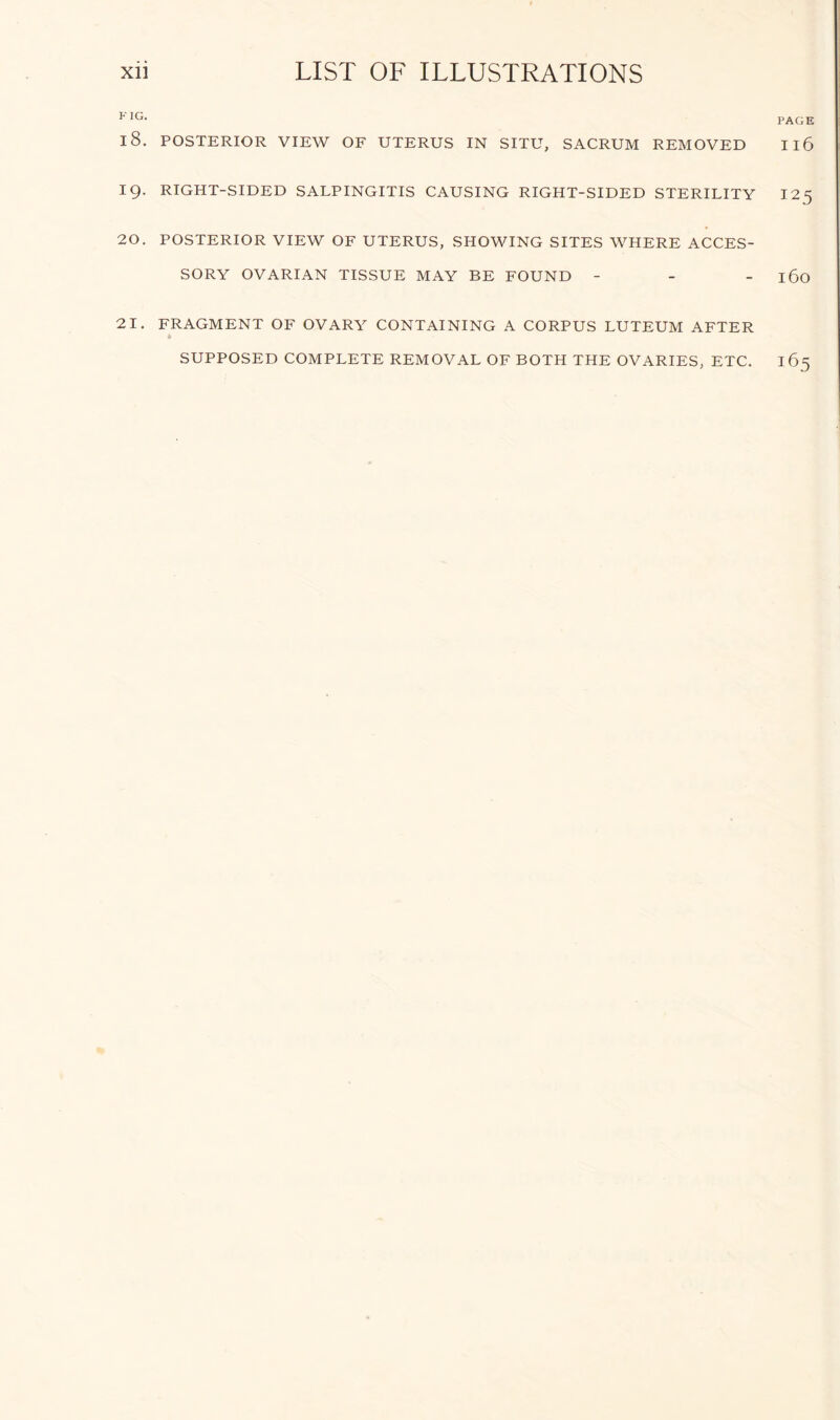 FIG- PAGE 18. POSTERIOR VIEW OF UTERUS IN SITU, SACRUM REMOVED Il6 19. RIGHT-SIDED SALPINGITIS CAUSING RIGHT-SIDED STERILITY 12 5 20. POSTERIOR VIEW OF UTERUS, SHOWING SITES WHERE ACCES- SORY OVARIAN TISSUE MAY BE FOUND - l6o 21. FRAGMENT OF OVARY CONTAINING A CORPUS LUTEUM AFTER ft SUPPOSED COMPLETE REMOVAL OF BOTH THE OVARIES, ETC.