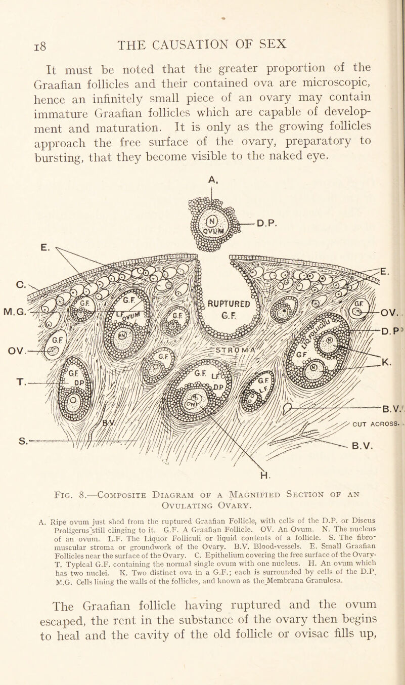 It must be noted that the greater proportion of the Graafian follicles and their contained ova are microscopic, hence an infinitely small piece of an ovary may contain immature Graafian follicles which are capable of develop- ment and maturation. It is only as the growing follicles approach the free surface of the ovary, preparatory to bursting, that they become visible to the naked eye. A. H. Fig. 8.—Composite Diagram of a Magnified Section of an Ovulating Ovary. A. Ripe ovum just shed from the ruptured Graafian Follicle, with cells of the D.P. or Discus Proligerusjstill clinging to it. G.F. A Graafian Follicle. OV. An Ovum. N. The nucleus of an ovum. L.F. The Liquor Folliculi or liquid contents of a follicle. S. The fibro- muscular stroma or groundwork of the Ovary. B.V. Blood-vessels. E. Small Graafian Follicles near the surface of the Ovary. C. Epithelium covering the free surface of the Ovary- T. Typical G.F. containing the normal single ovum with one nucleus. H. An ovum which has two nuclei. K. Two distinct ova in a G.F.; each is surrounded by cells of the D.P. M.G. Cells lining the walls of the follicles, and known as the_Membrana Granulosa. The Graafian follicle having ruptured and the ovum escaped, the rent in the substance of the ovary then begins to heal and the cavity of the old follicle or ovisac fills up,